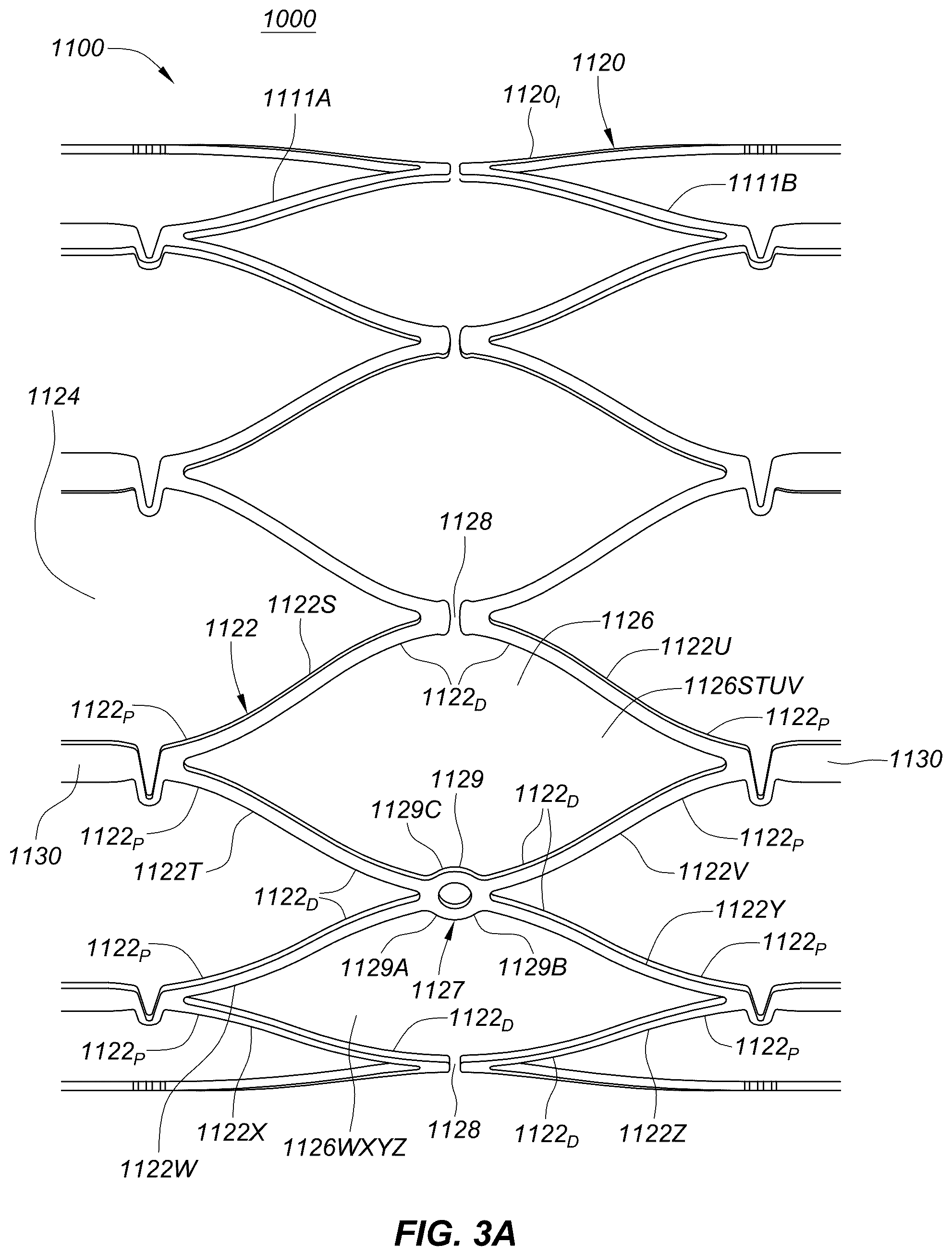 Patent US12551329 Figure 6 – Transcatheter growth devices and methods for Norwood, Glenn and Fontan therapy