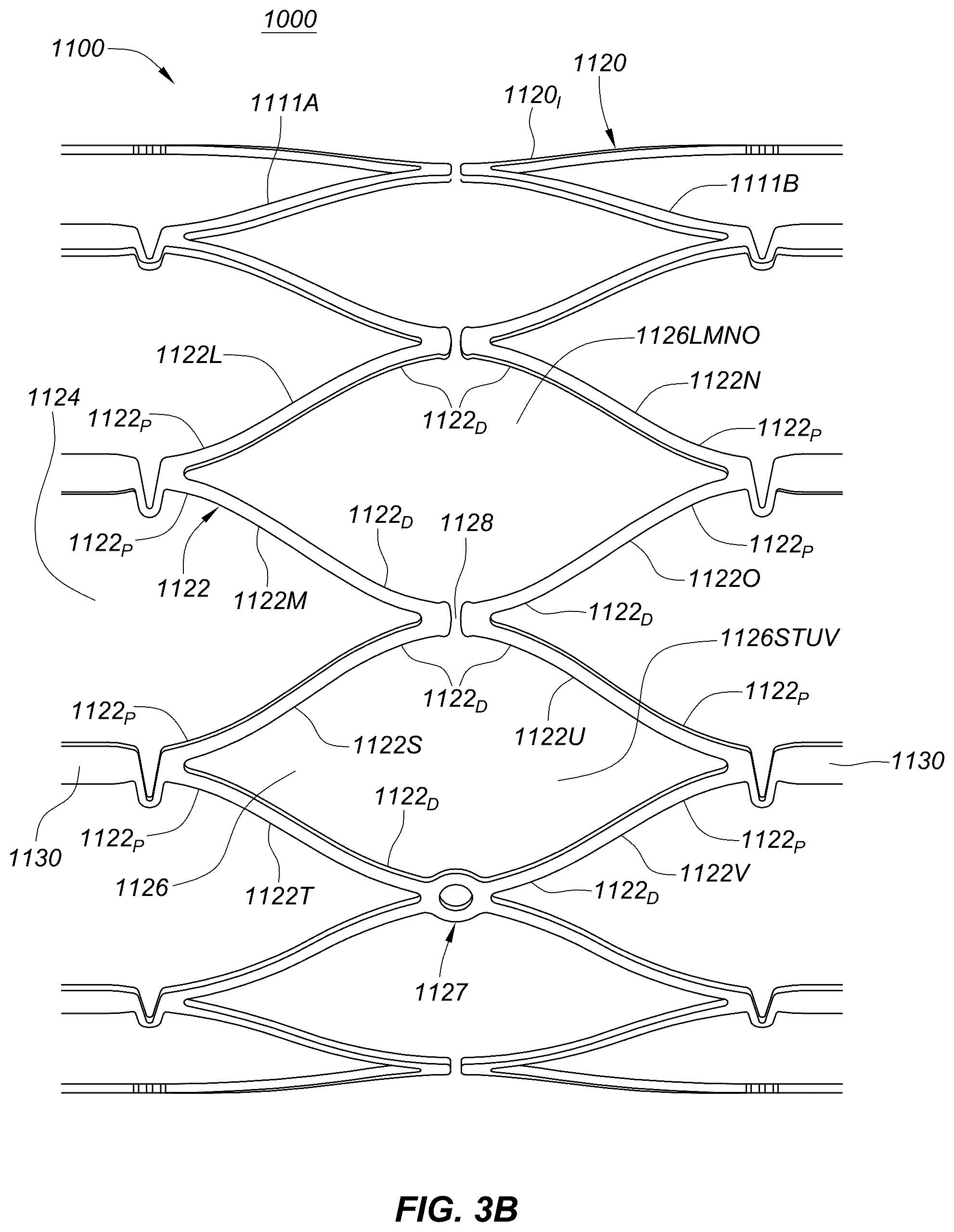 Patent US12551329 Figure 7 – Transcatheter growth devices and methods for Norwood, Glenn and Fontan therapy
