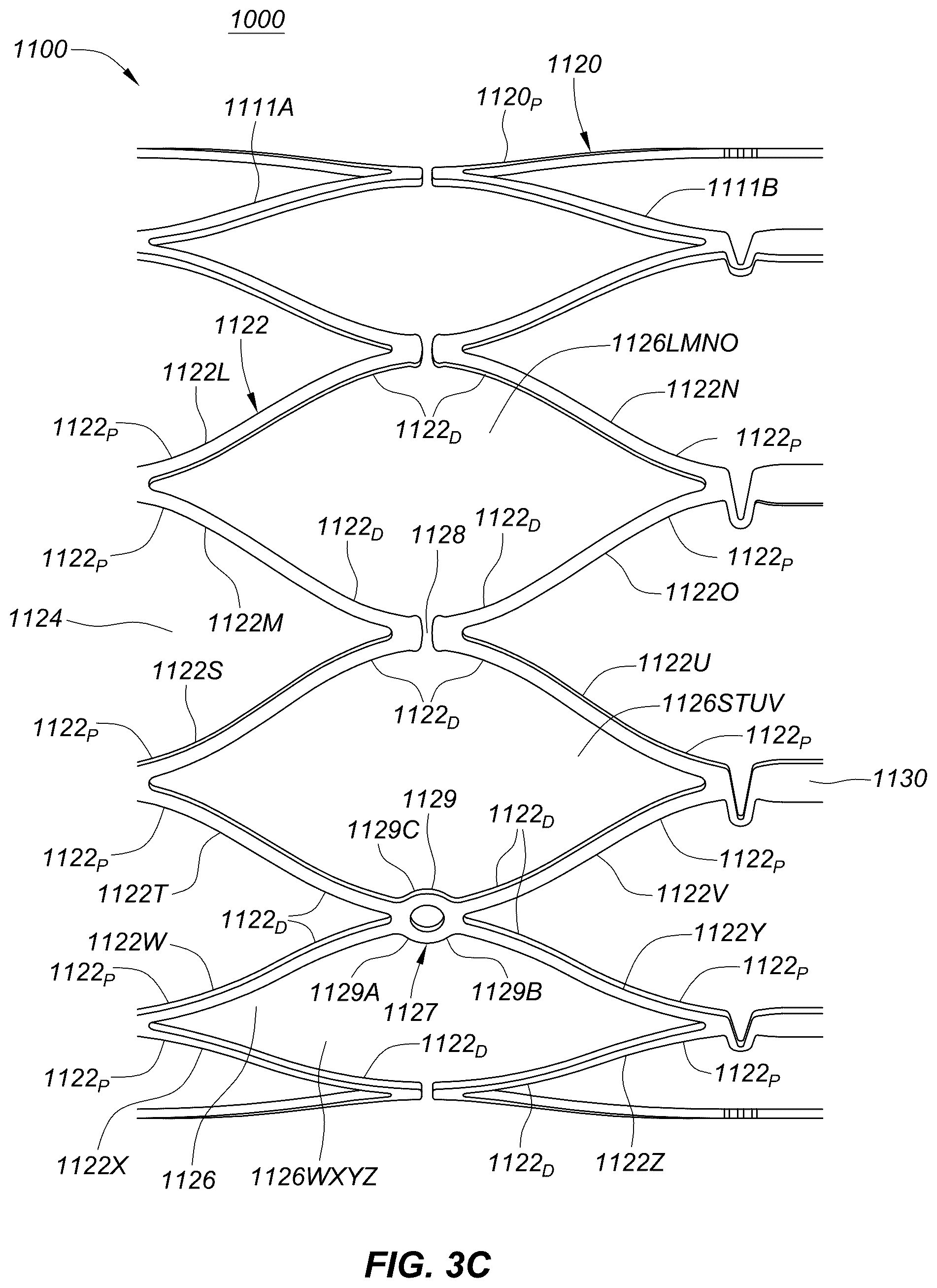 Patent US12551329 Figure 8 – Transcatheter growth devices and methods for Norwood, Glenn and Fontan therapy