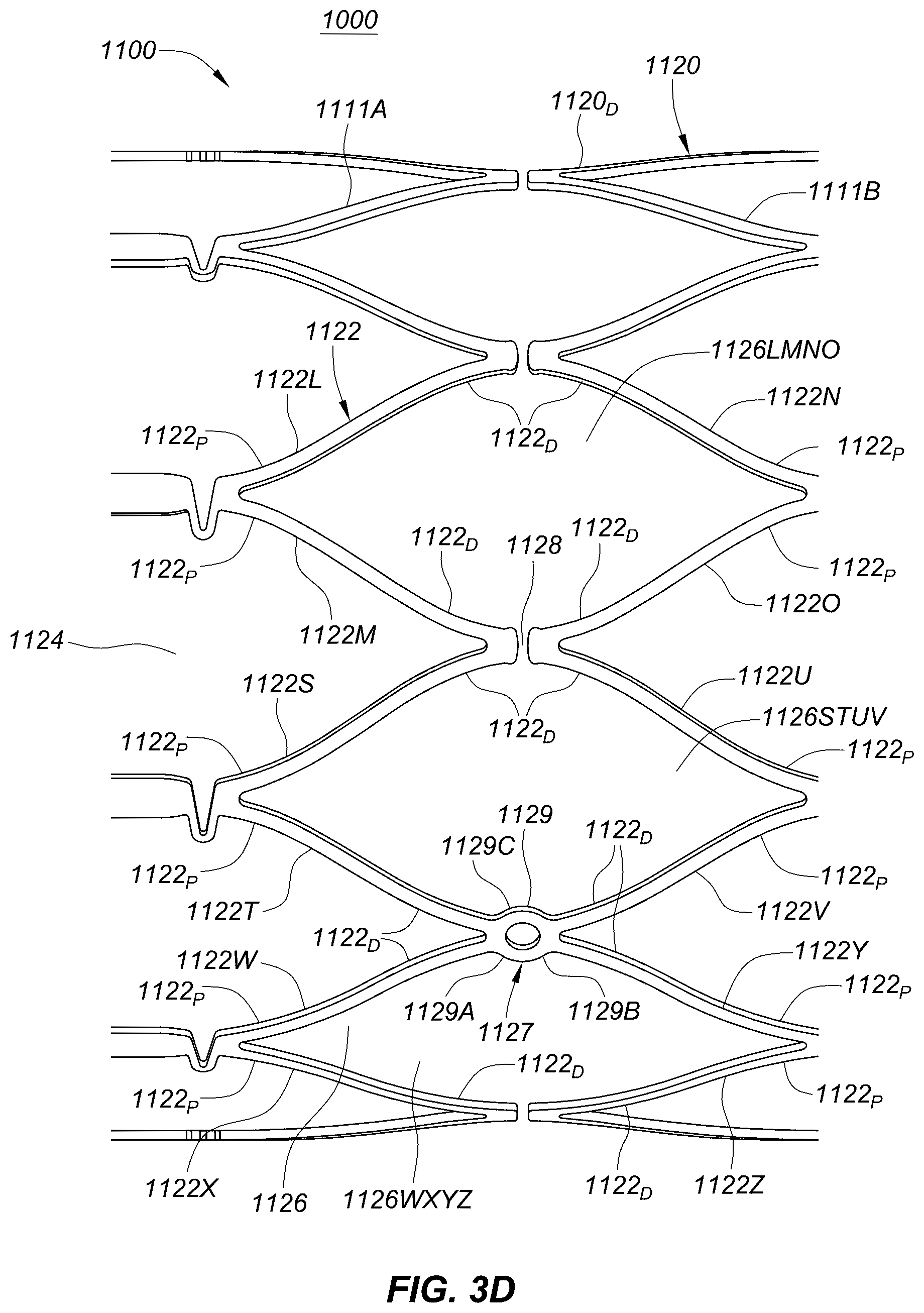 Patent US12551329 Figure 9 – Transcatheter growth devices and methods for Norwood, Glenn and Fontan therapy
