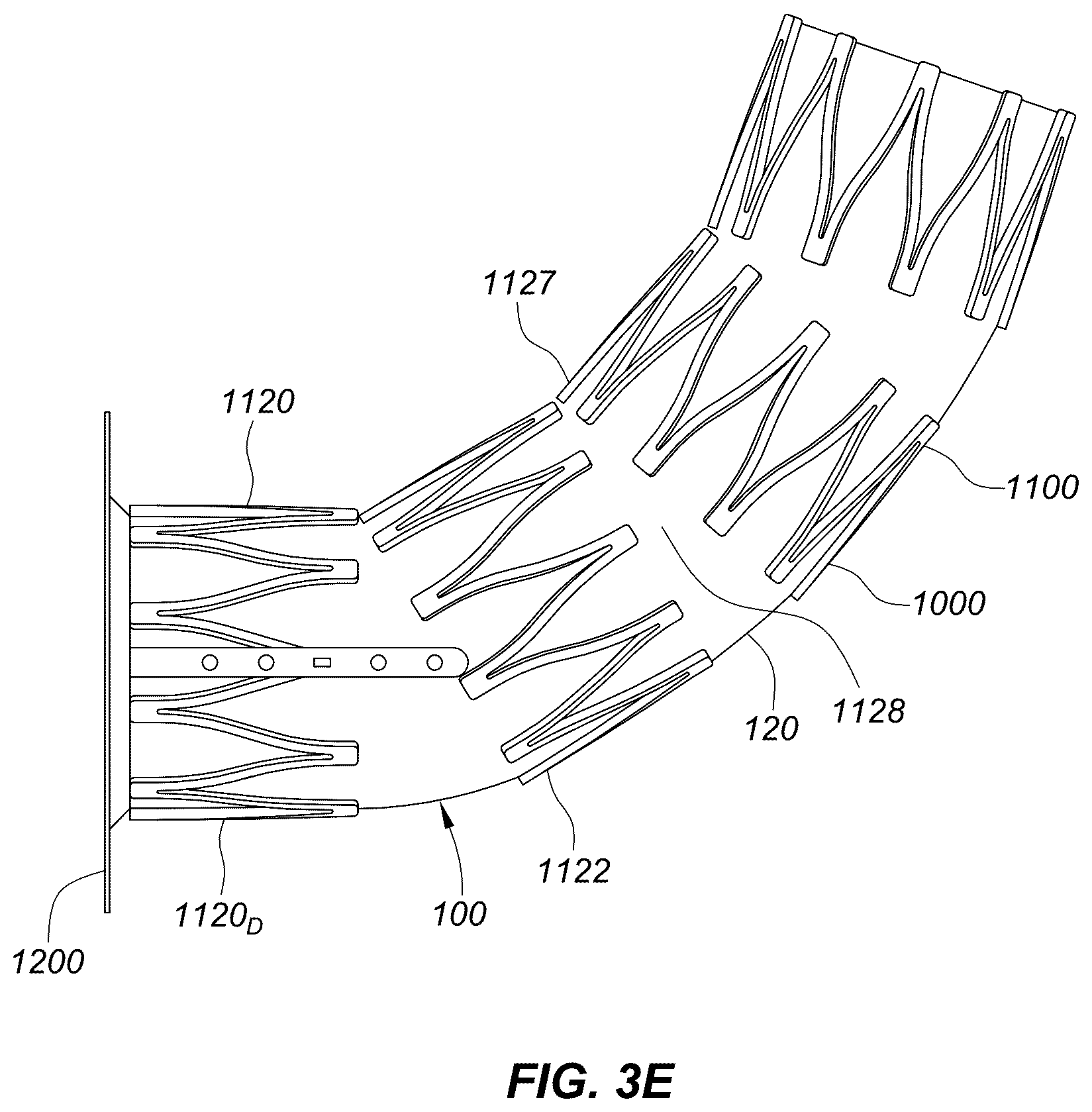 Patent US12551329 Figure 10 – Transcatheter growth devices and methods for Norwood, Glenn and Fontan therapy