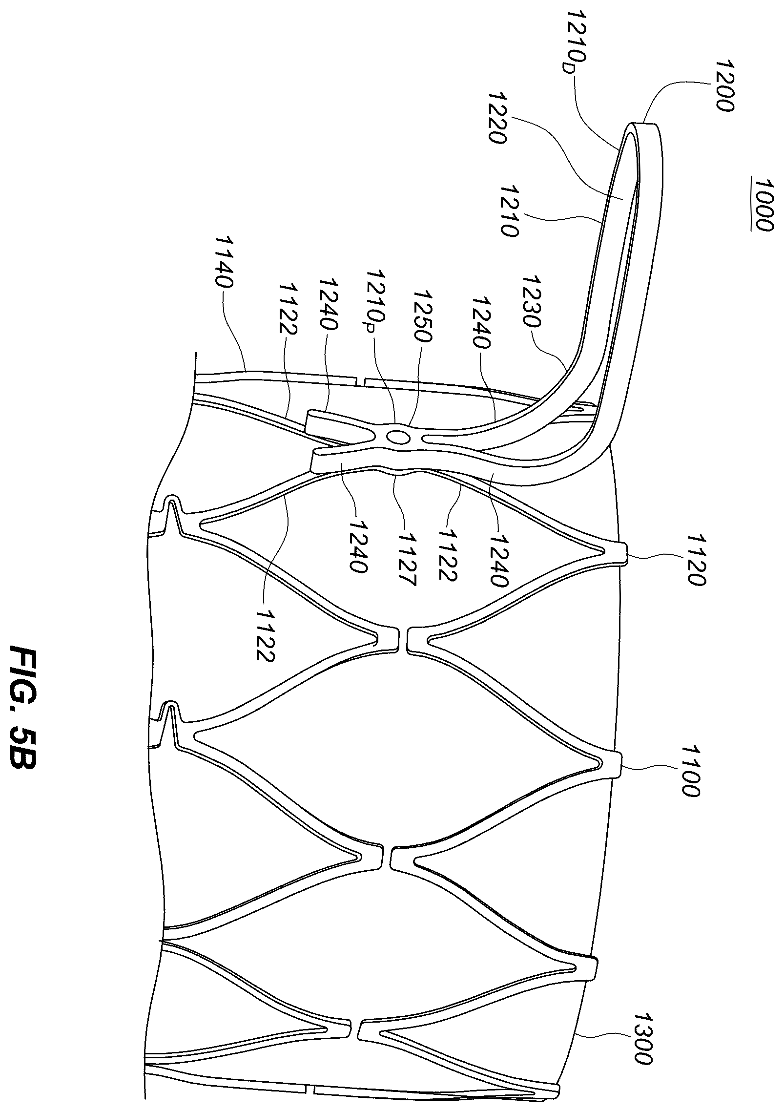 Patent US12551329 Figure 13 – Transcatheter growth devices and methods for Norwood, Glenn and Fontan therapy