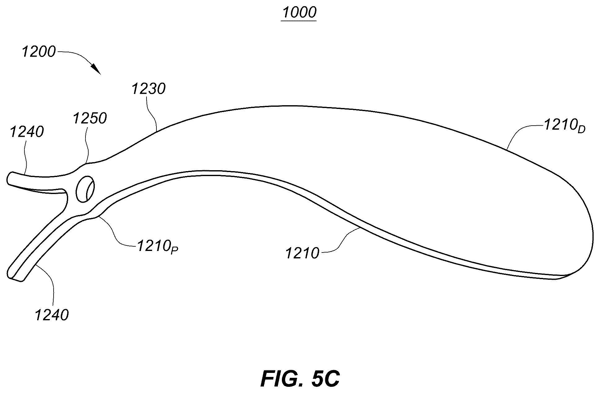 Patent US12551329 Figure 14 – Transcatheter growth devices and methods for Norwood, Glenn and Fontan therapy