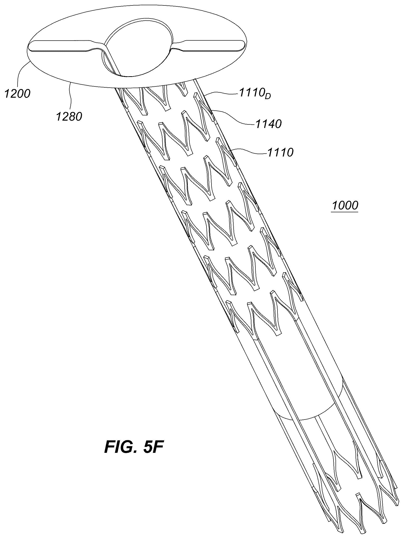 Patent US12551329 Figure 17 – Transcatheter growth devices and methods for Norwood, Glenn and Fontan therapy