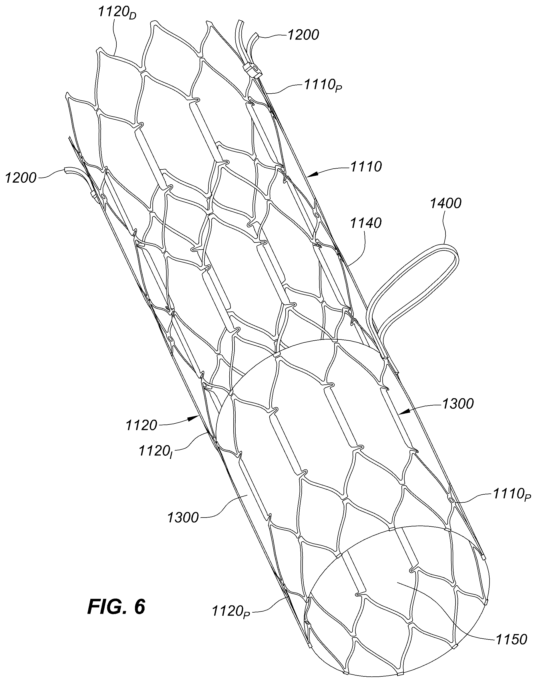 Patent US12551329 Figure 18 – Transcatheter growth devices and methods for Norwood, Glenn and Fontan therapy