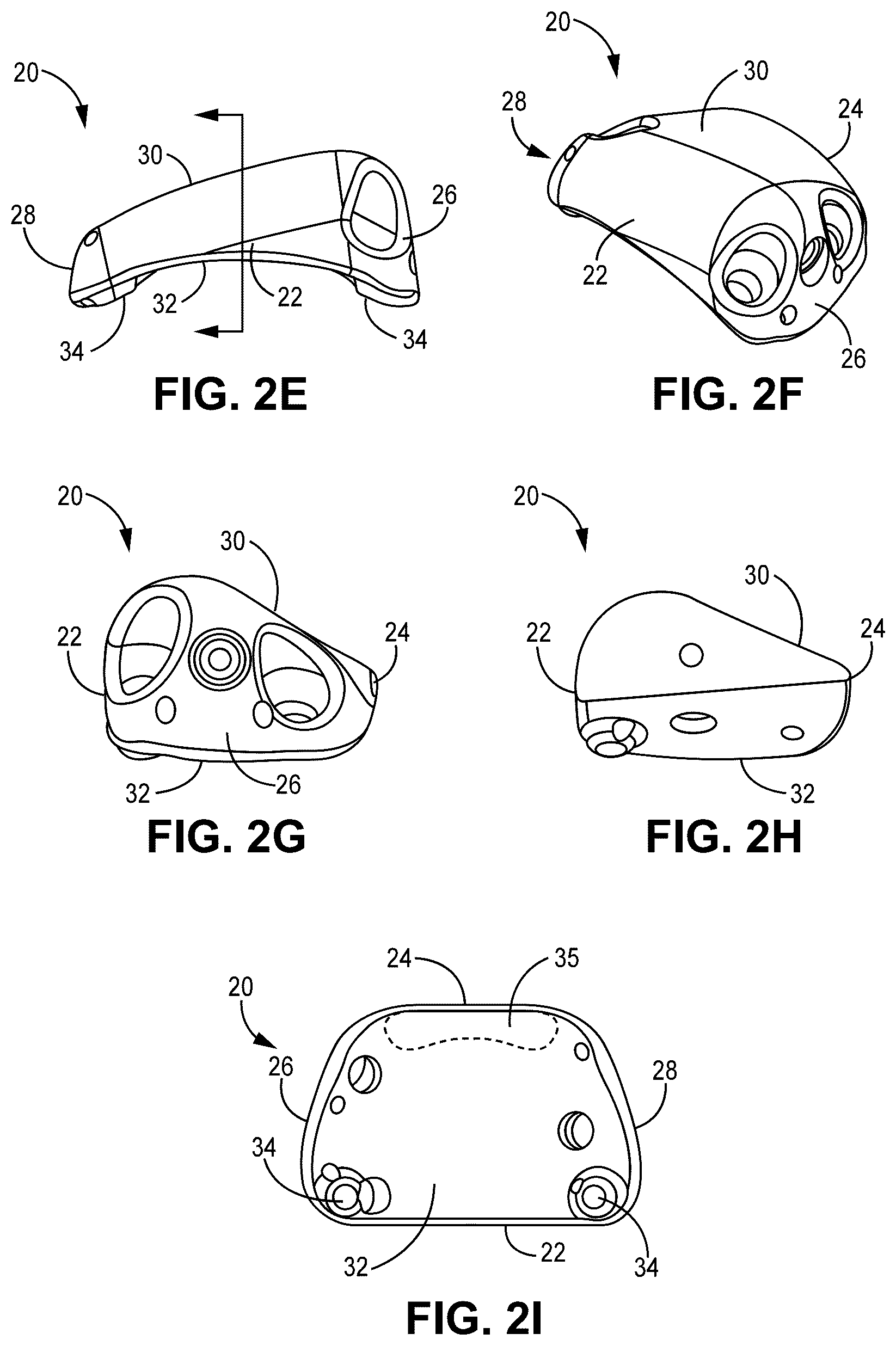 Patent US12551330 Figure 3 – Multiplanar tendon realignment implants and related systems and methods