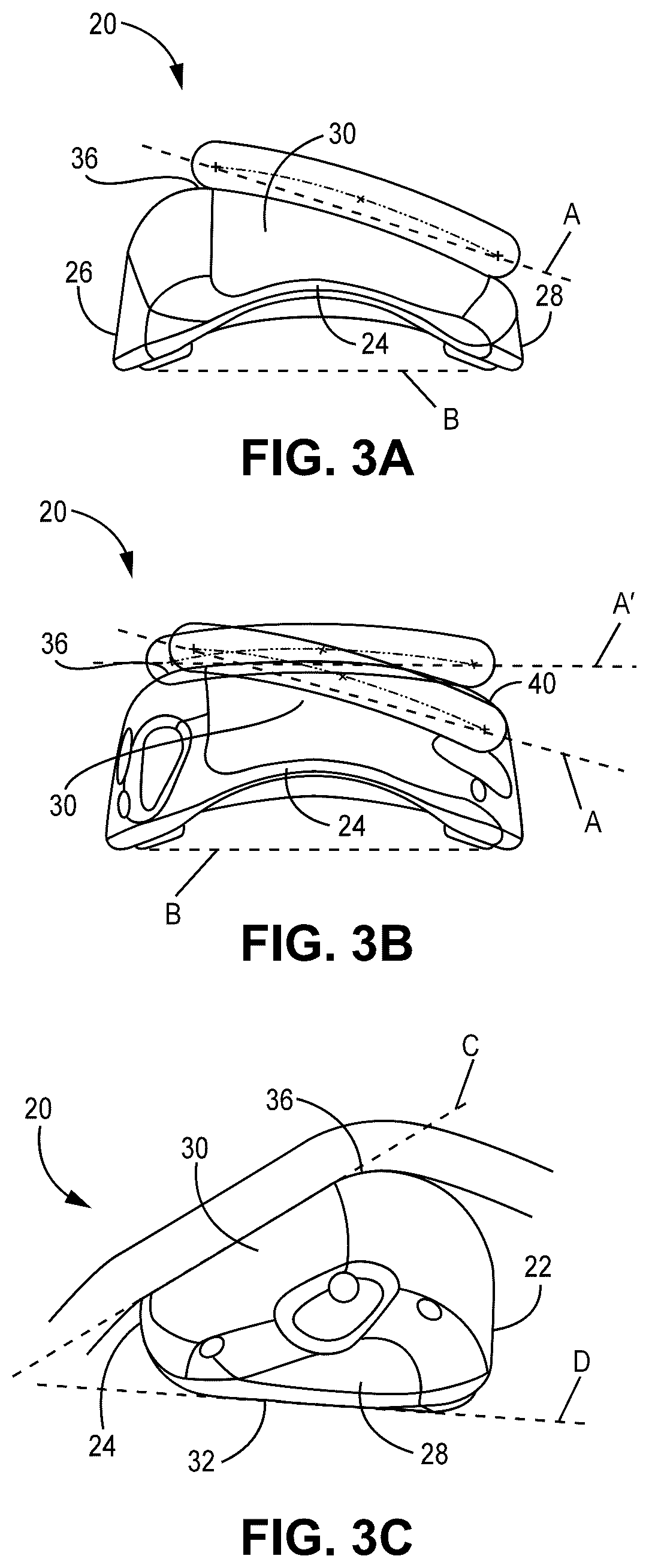 Patent US12551330 Figure 4 – Multiplanar tendon realignment implants and related systems and methods