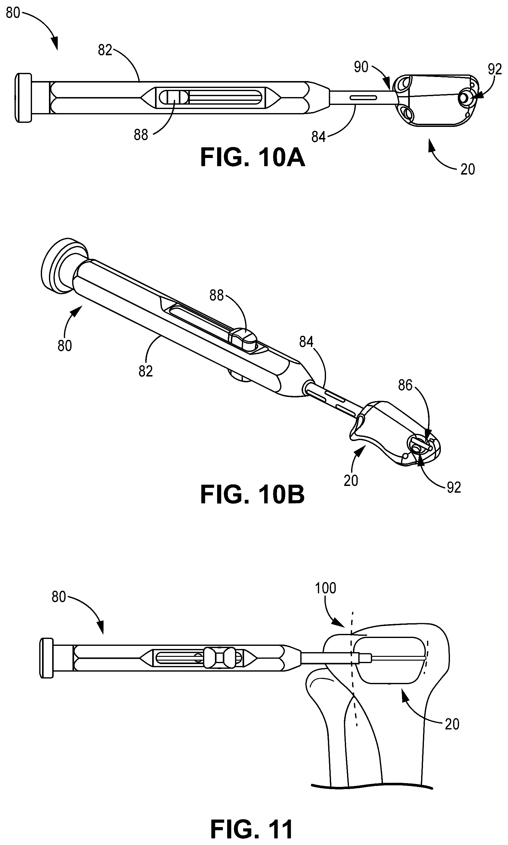 Patent US12551330 Figure 8 – Multiplanar tendon realignment implants and related systems and methods