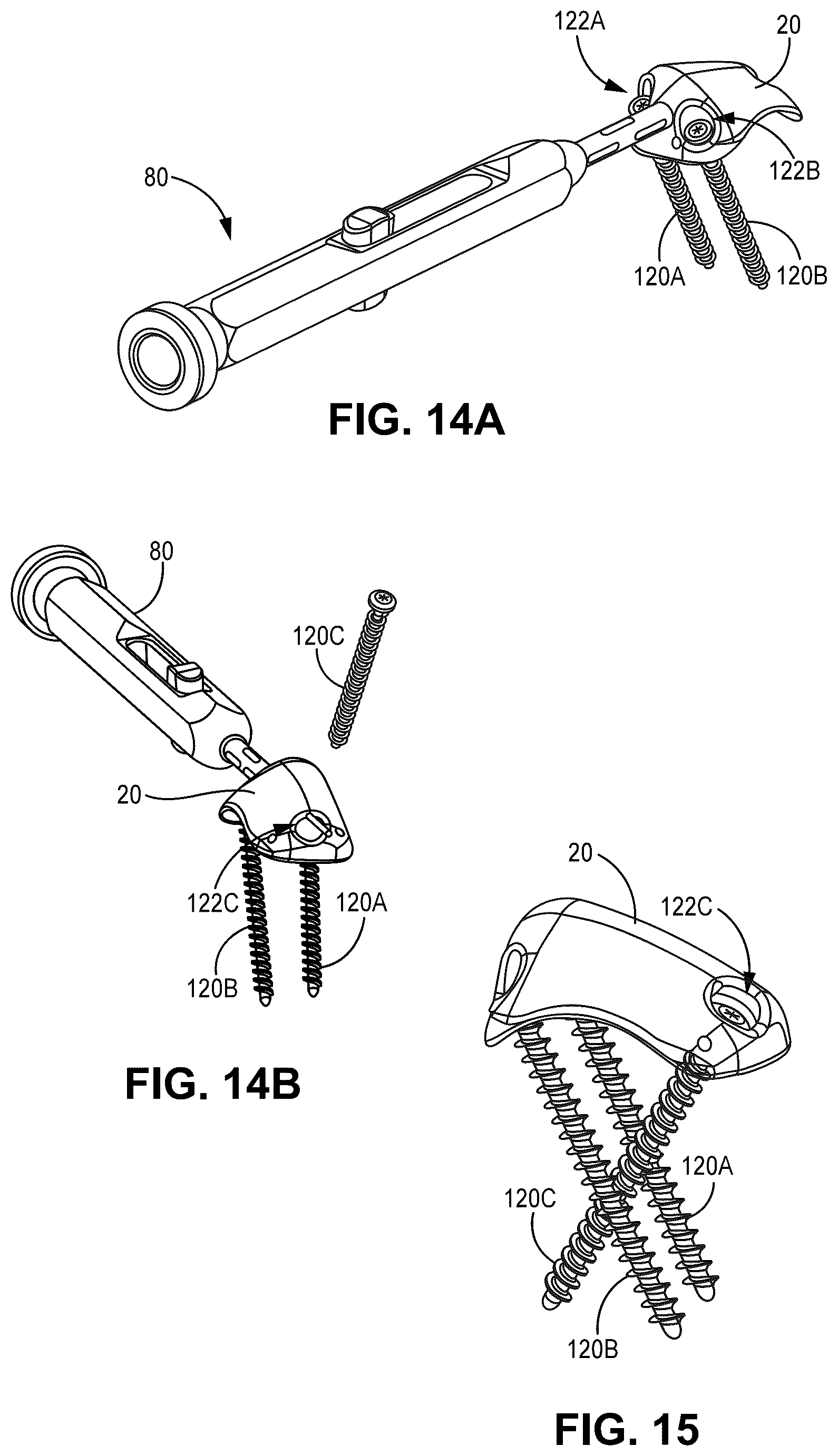 Patent US12551330 Figure 10 – Multiplanar tendon realignment implants and related systems and methods