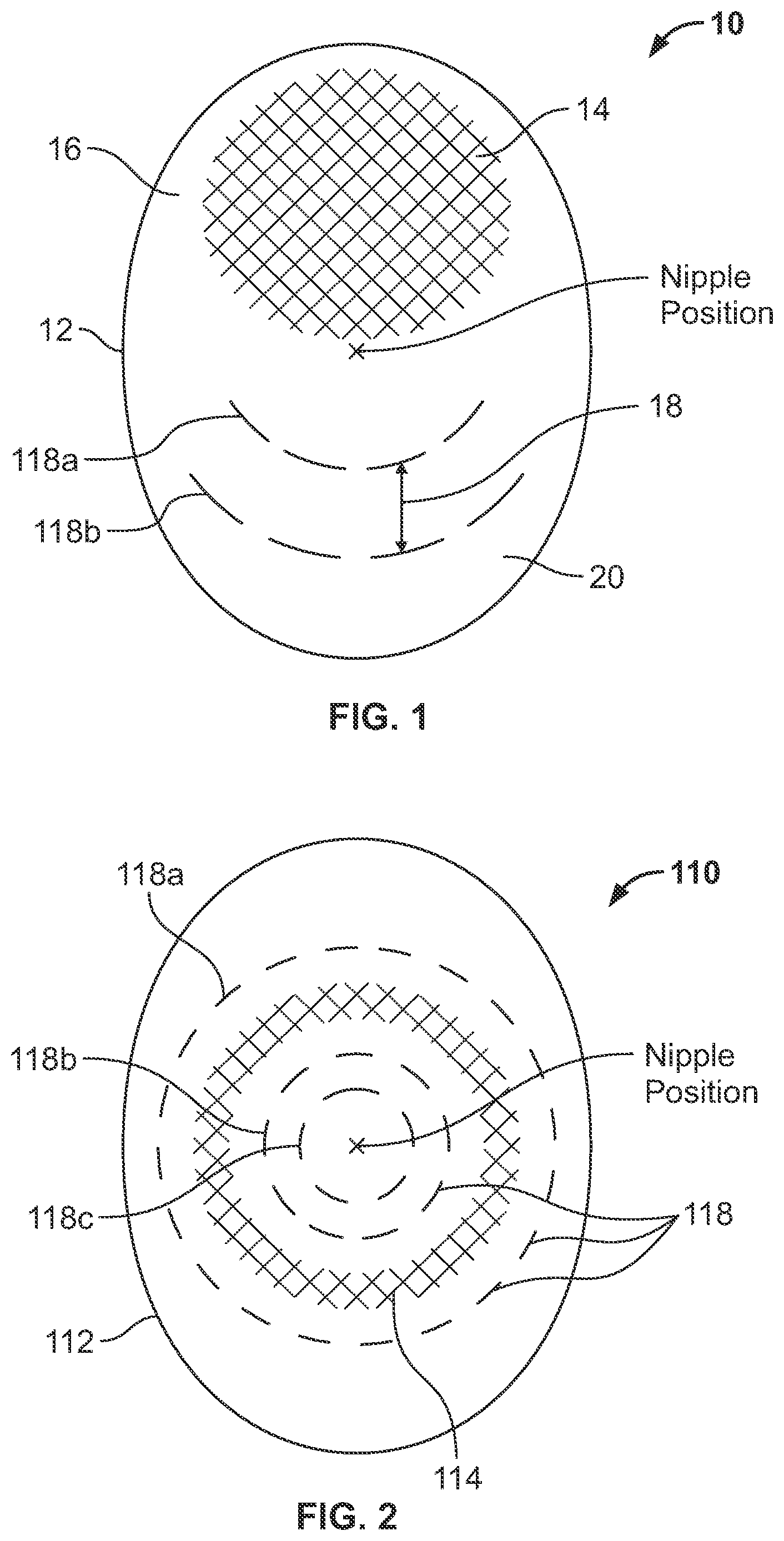 Patent US12551331 Figure 1 – Diversified grafts having heterogenous features and methods for making and using same