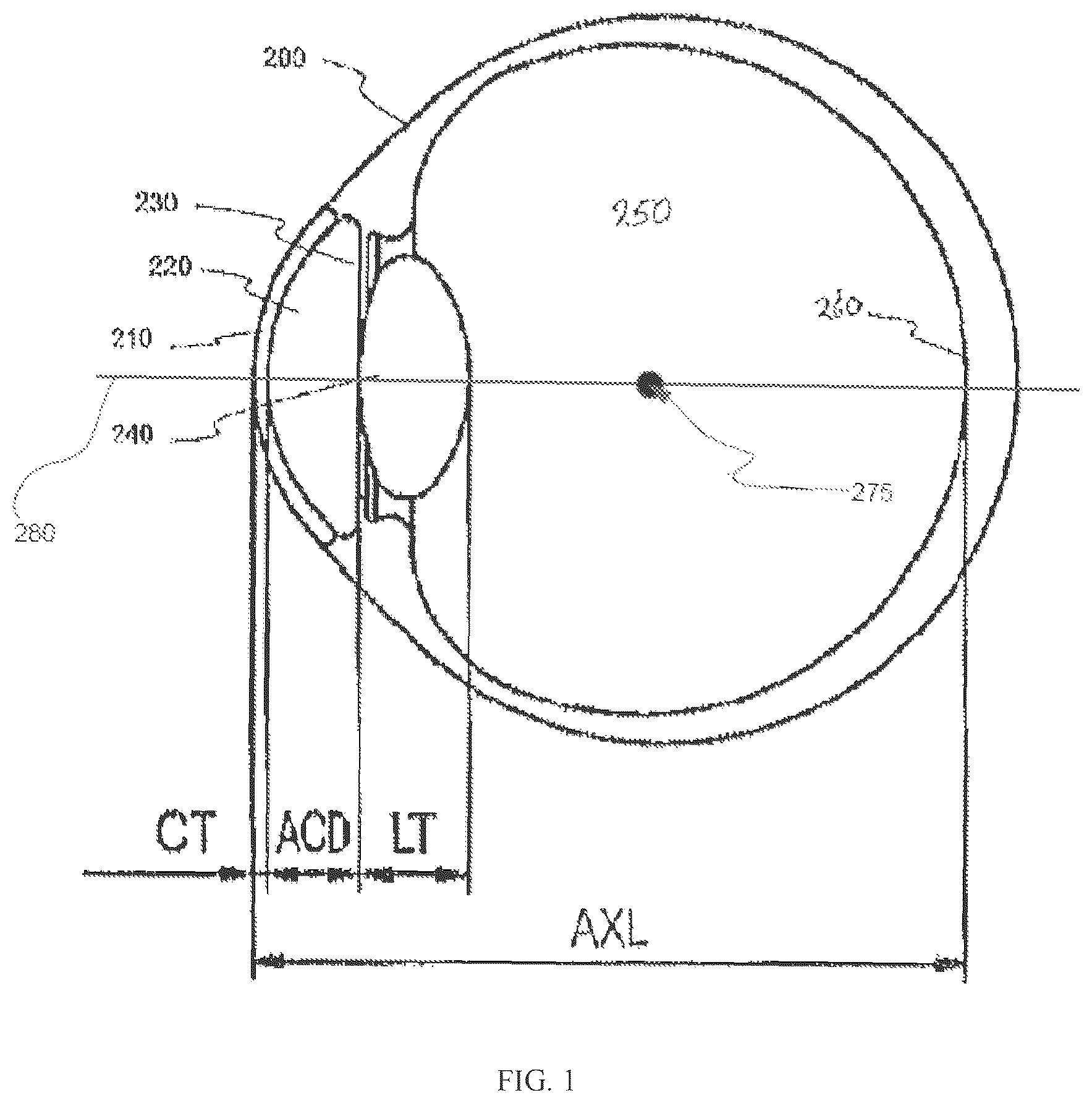 Patent US12551332 — Piggyback intraocular lens that improves overall vision where there is a local loss of retinal function — Figure 1
