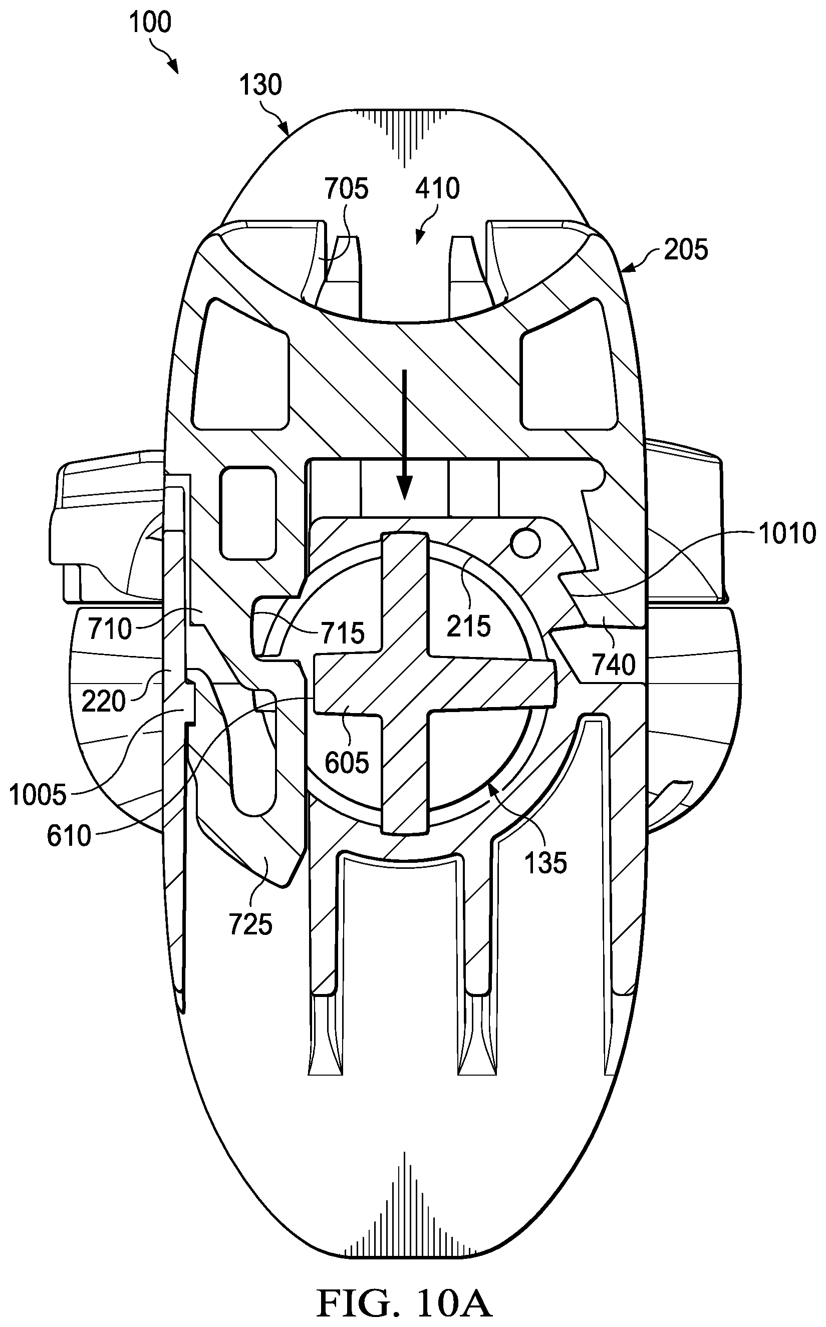Patent US12551334 Figure 7 – Surgical implant delivery with lockable plunger