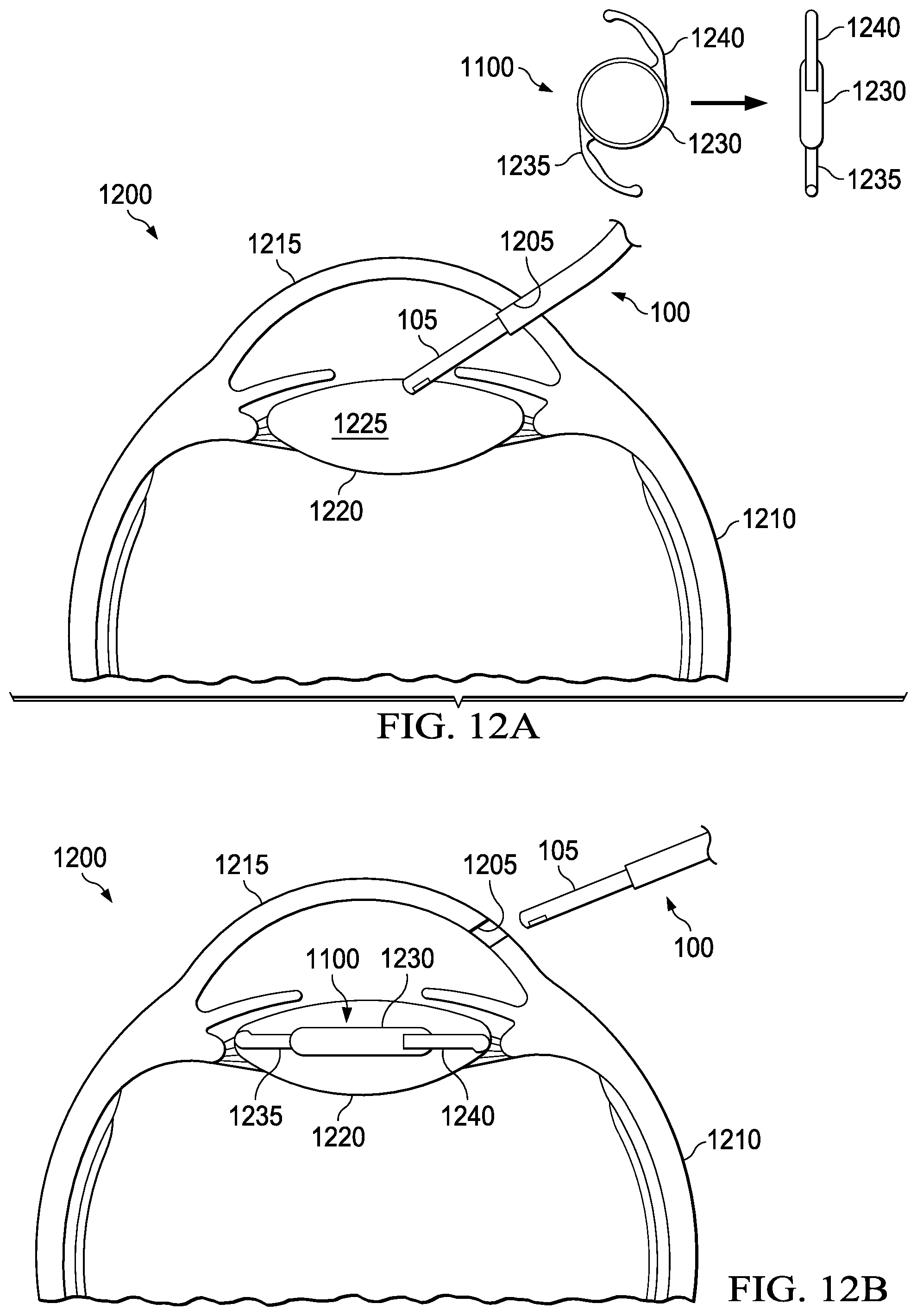 Patent US12551334 Figure 10 – Surgical implant delivery with lockable plunger