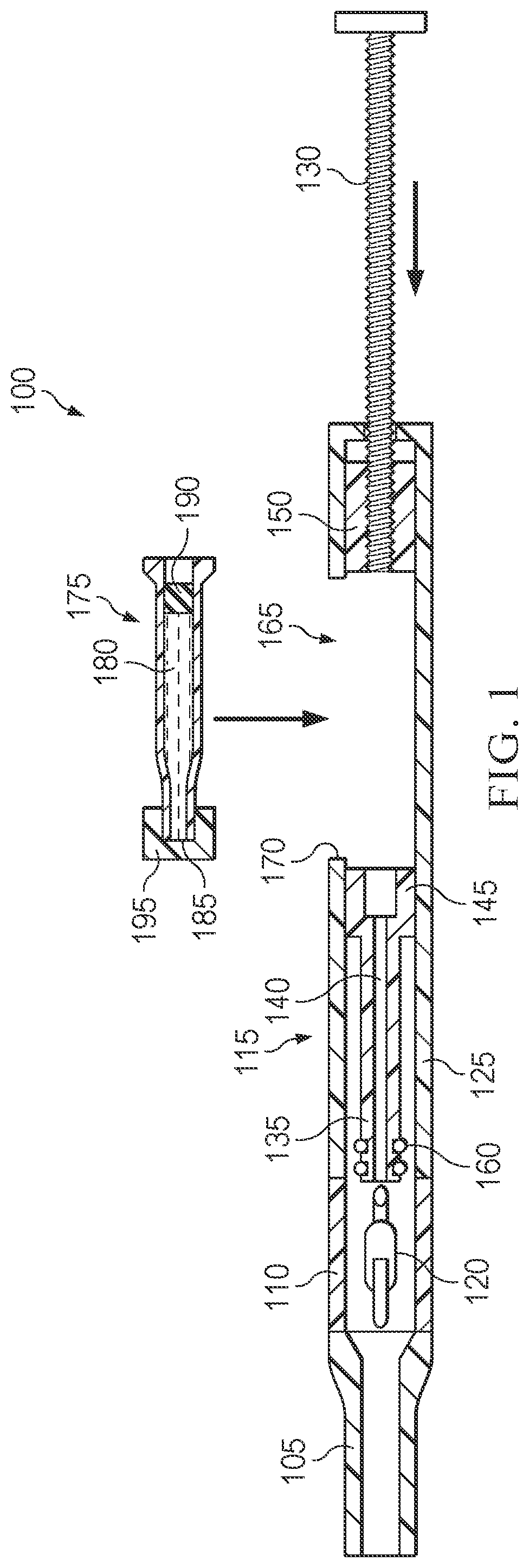 Patent US12551335 Figure 1 – Hydraulic delivery of surgical implants