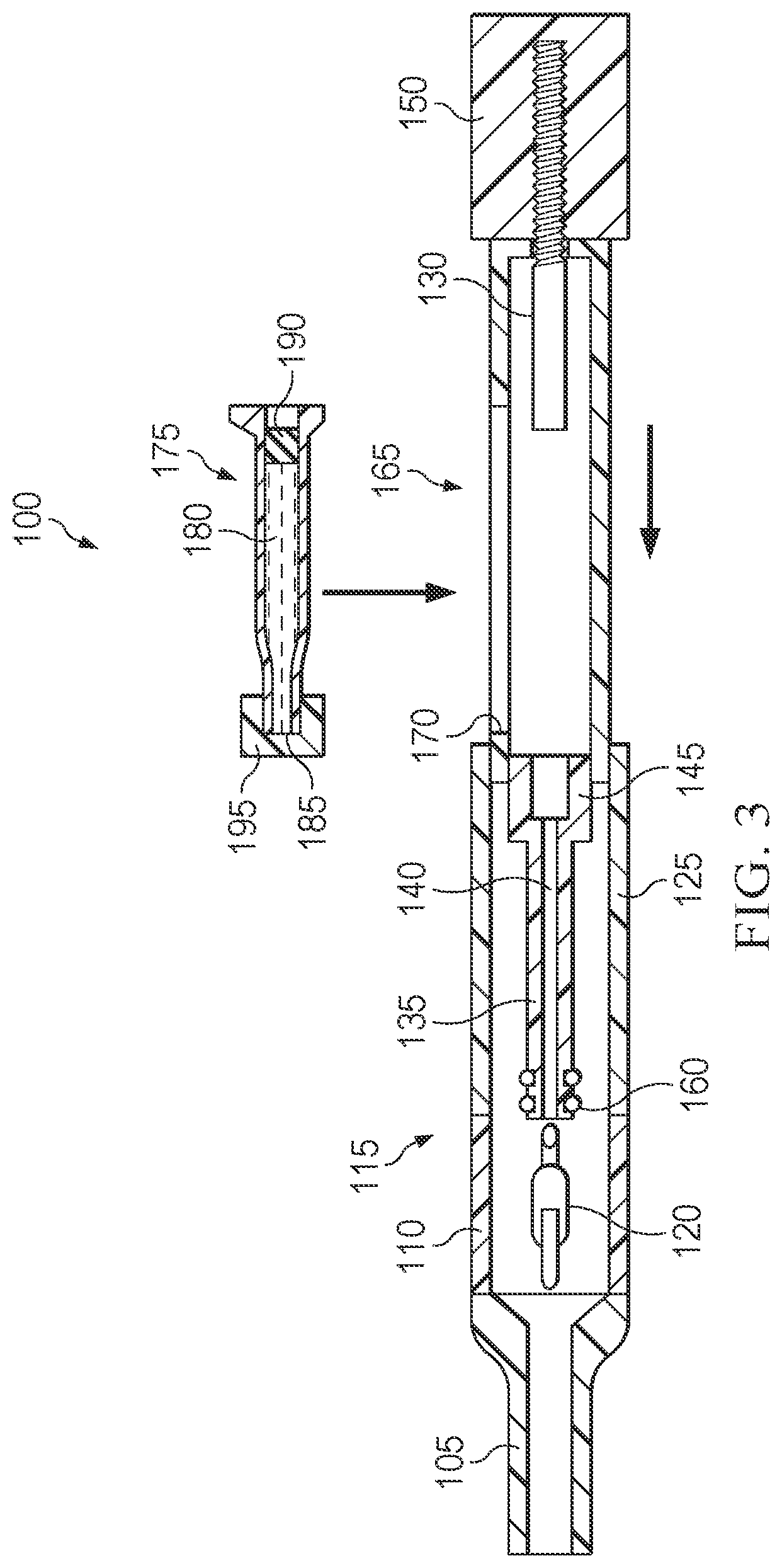 Patent US12551335 Figure 3 – Hydraulic delivery of surgical implants