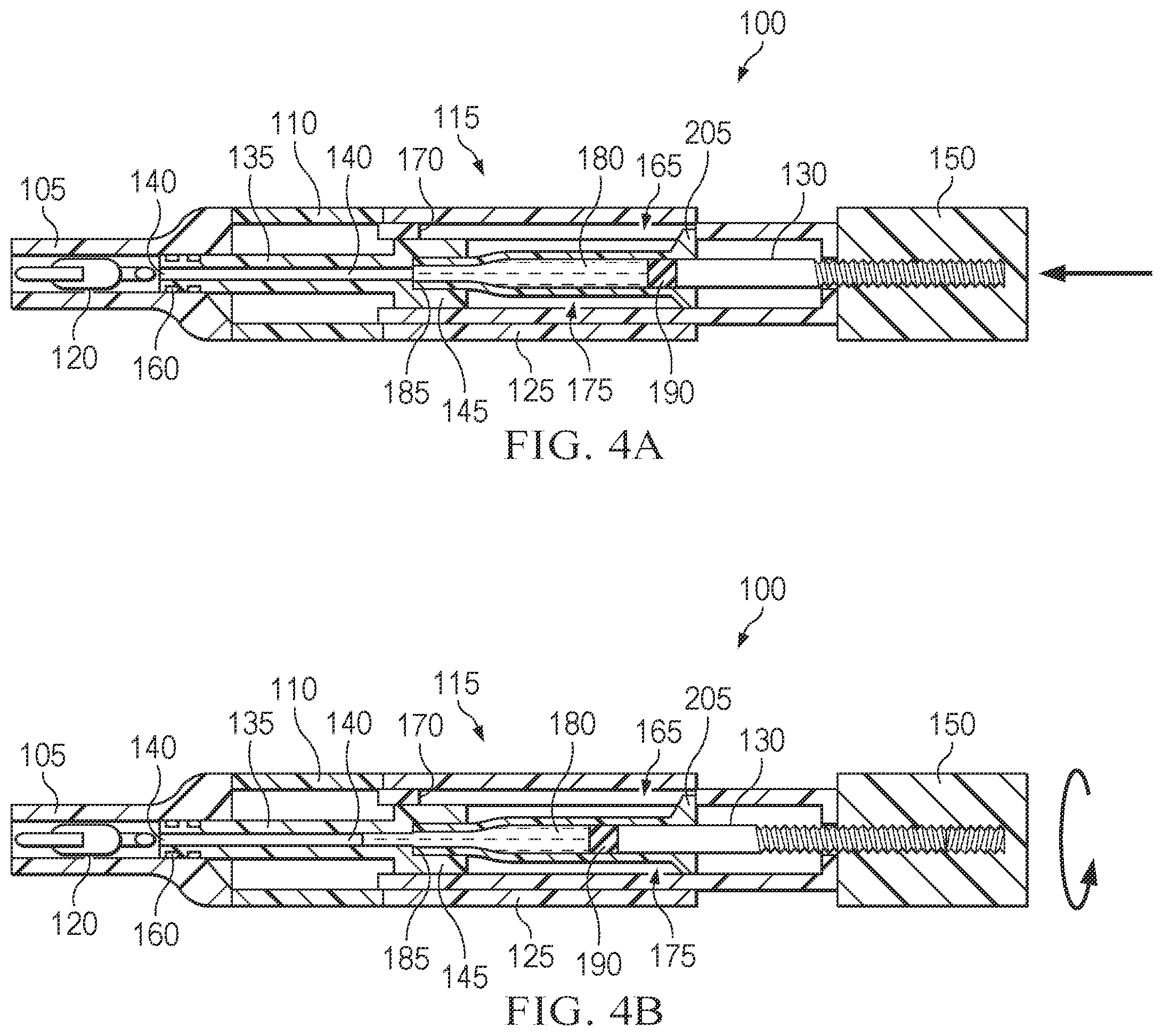 Patent US12551335 Figure 4 – Hydraulic delivery of surgical implants