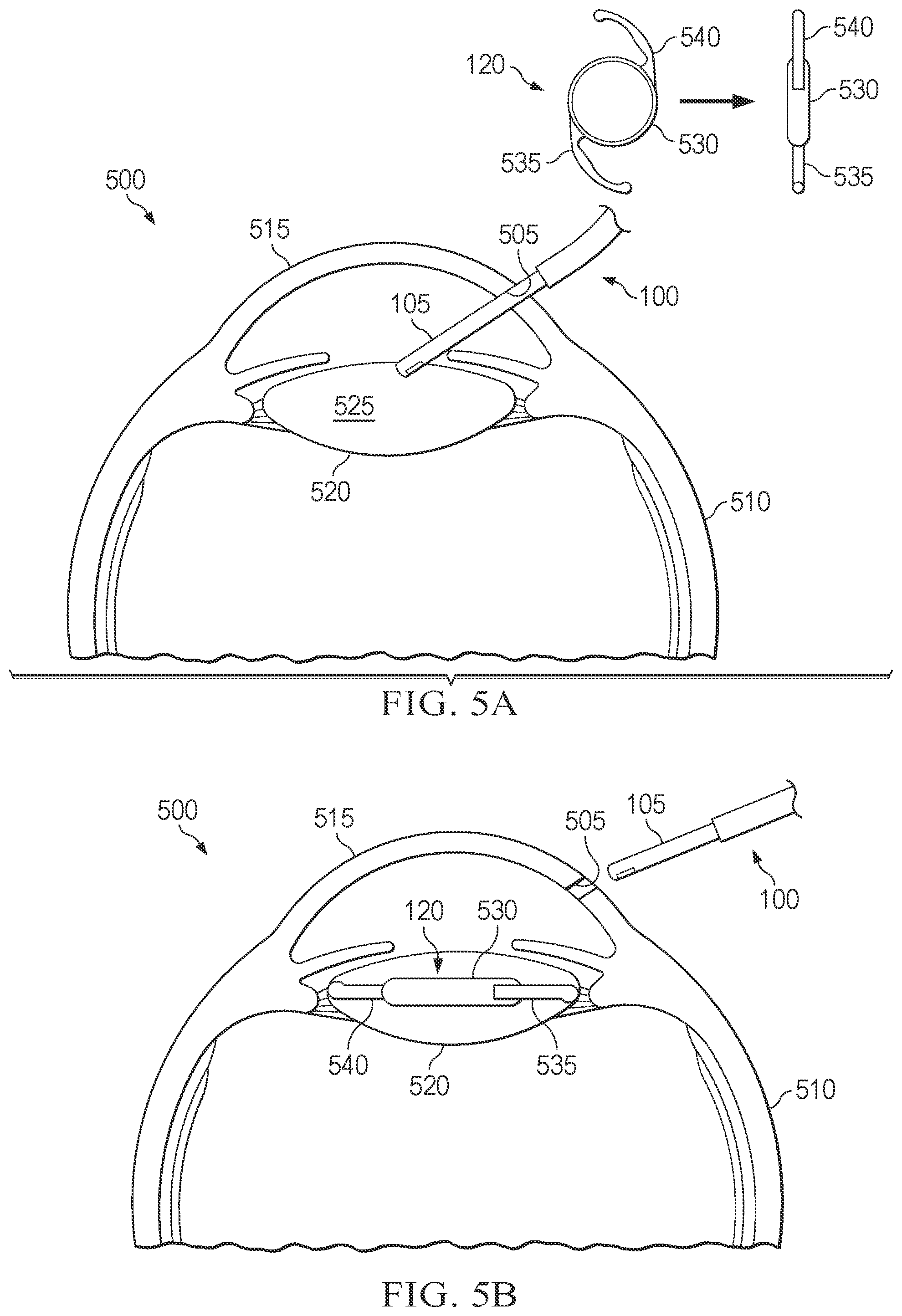 Patent US12551335 Figure 5 – Hydraulic delivery of surgical implants