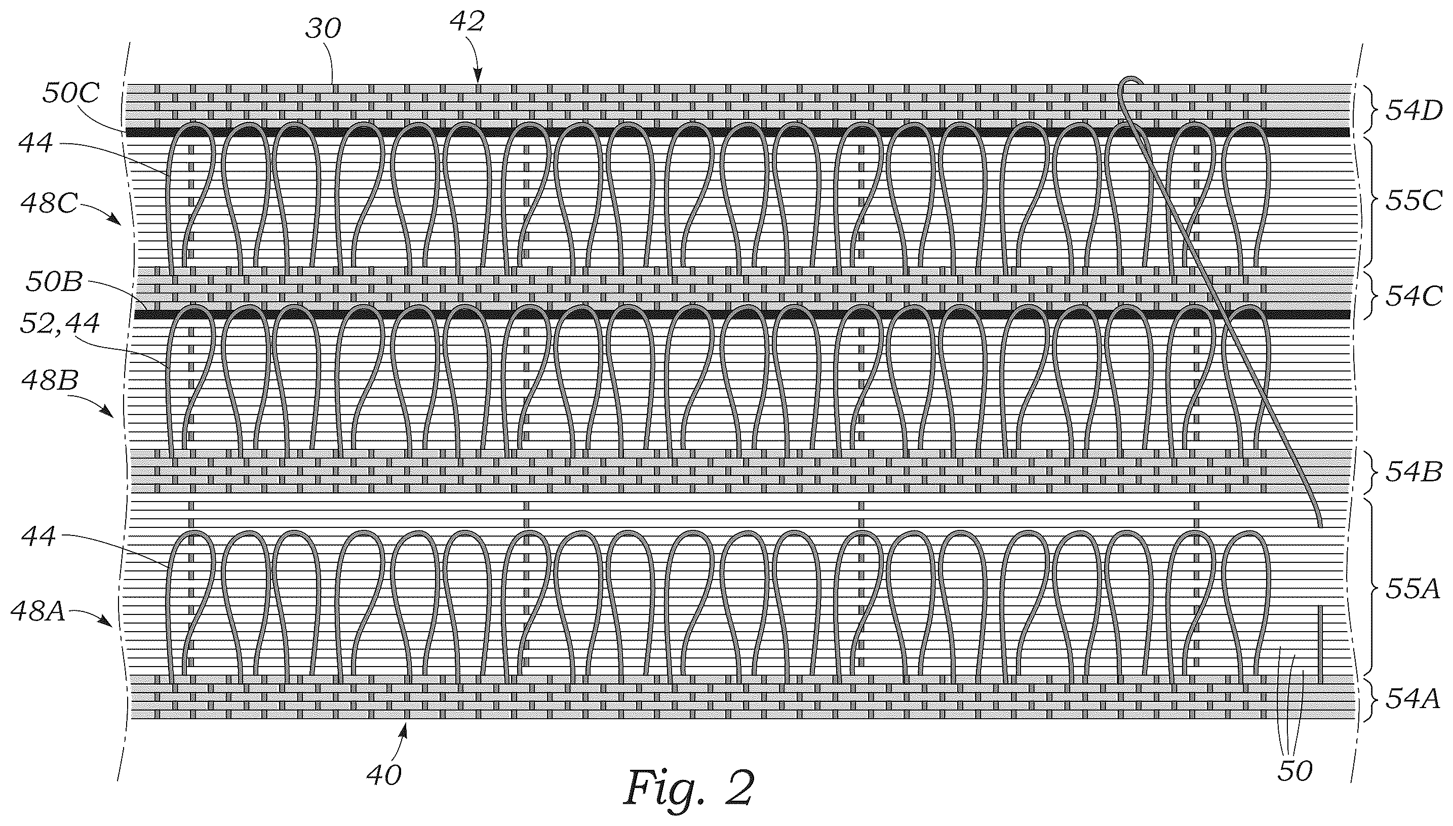 Patent US12551336 Figure 2 – Sealing element for prosthetic heart valve