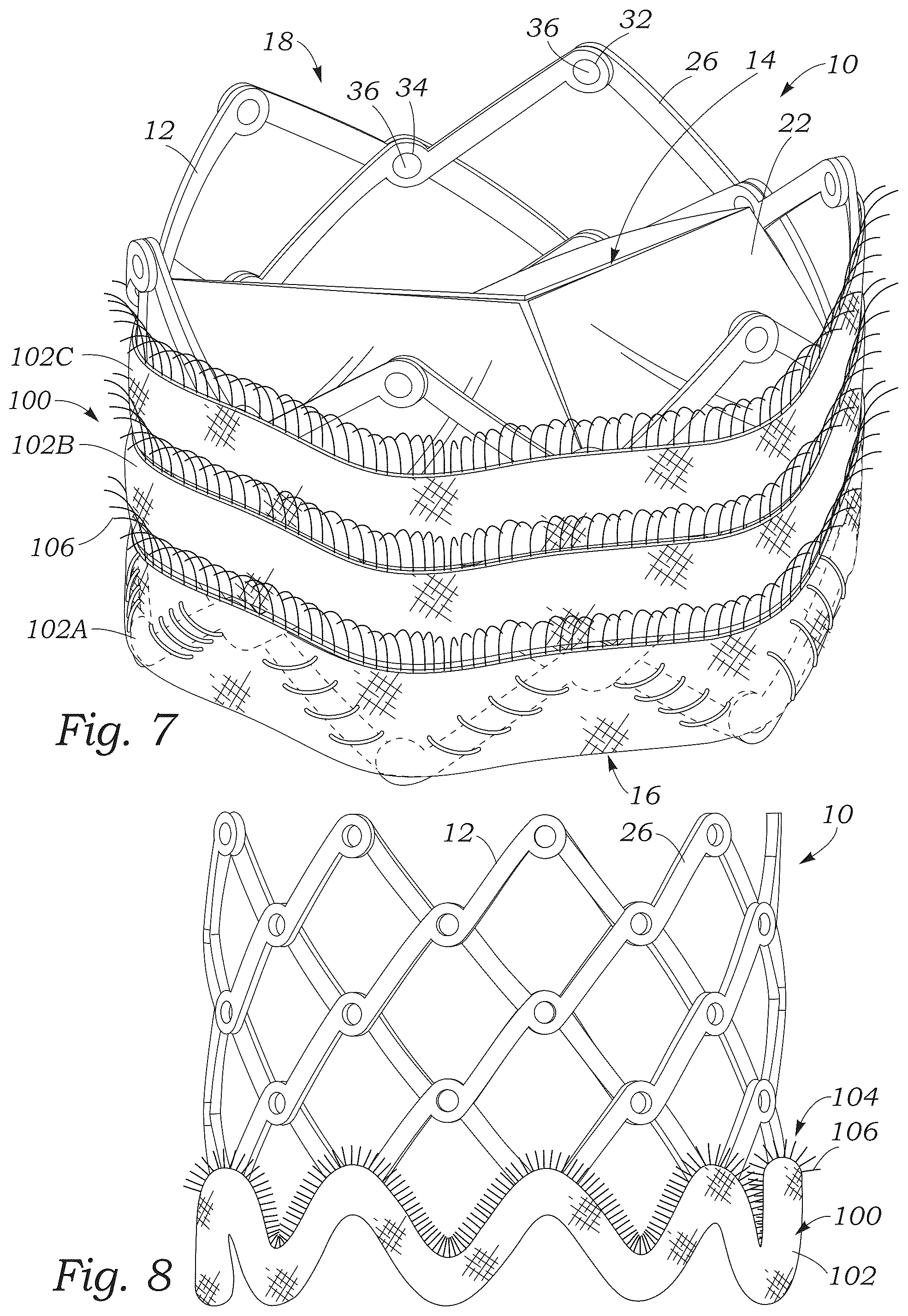 Patent US12551336 Figure 5 – Sealing element for prosthetic heart valve