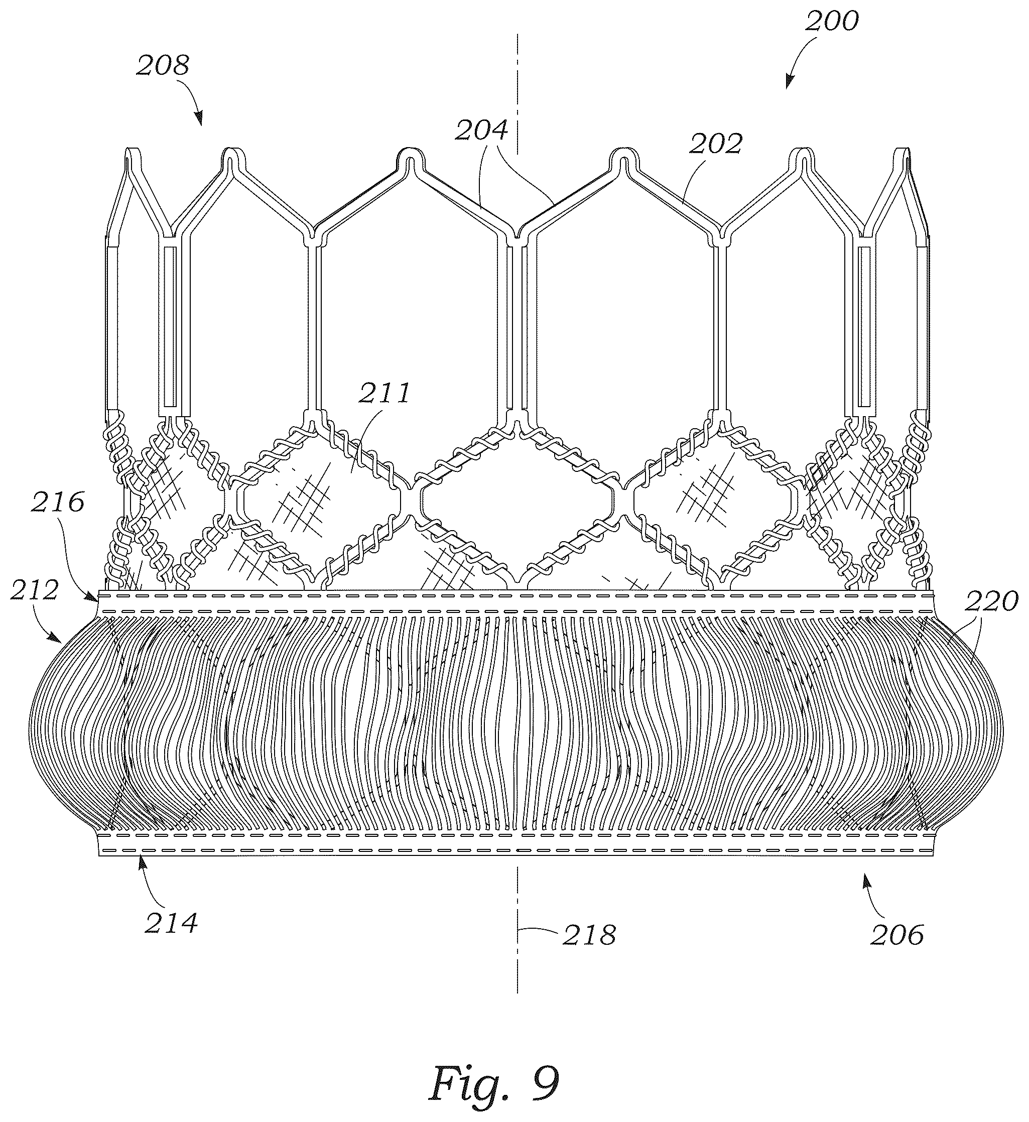 Patent US12551336 Figure 6 – Sealing element for prosthetic heart valve