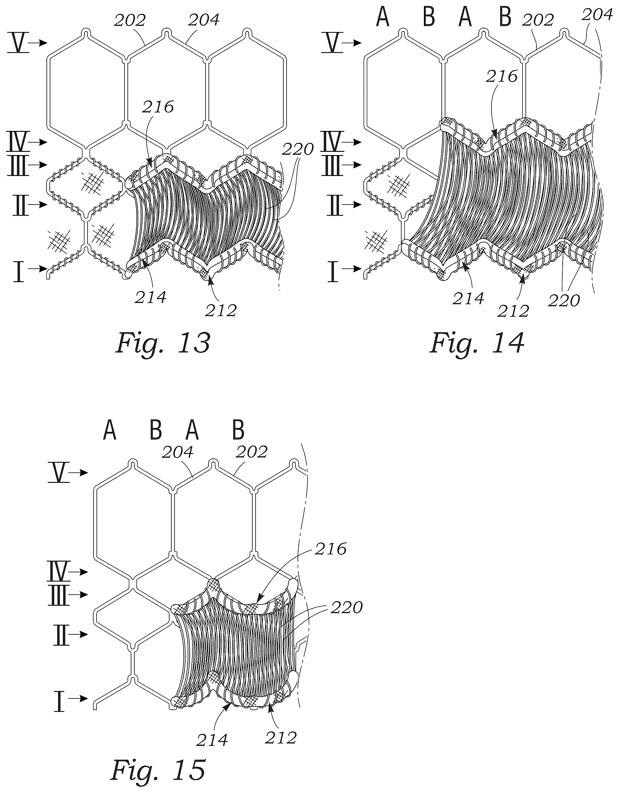 Patent US12551336 Figure 8 – Sealing element for prosthetic heart valve