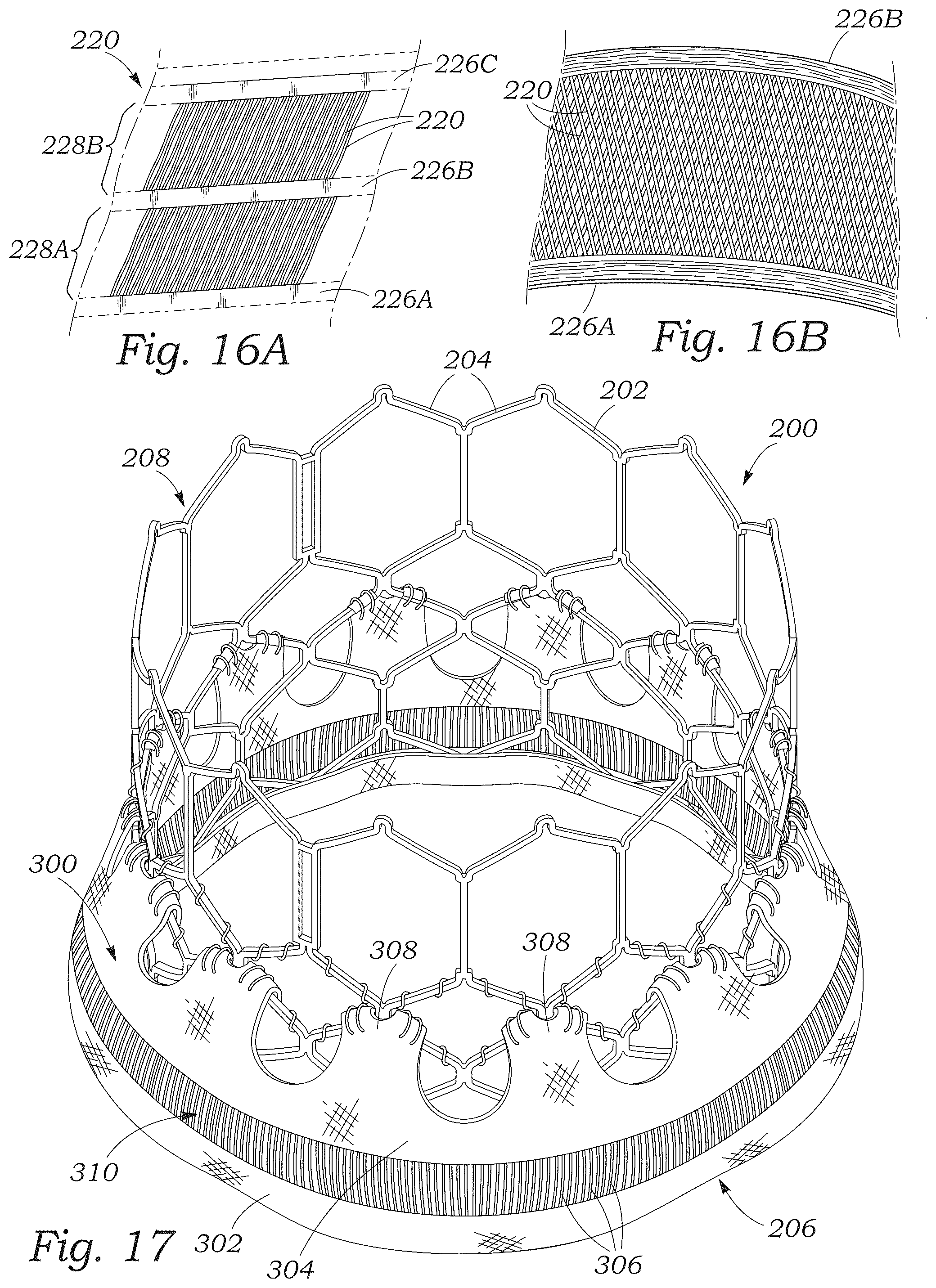Patent US12551336 Figure 9 – Sealing element for prosthetic heart valve