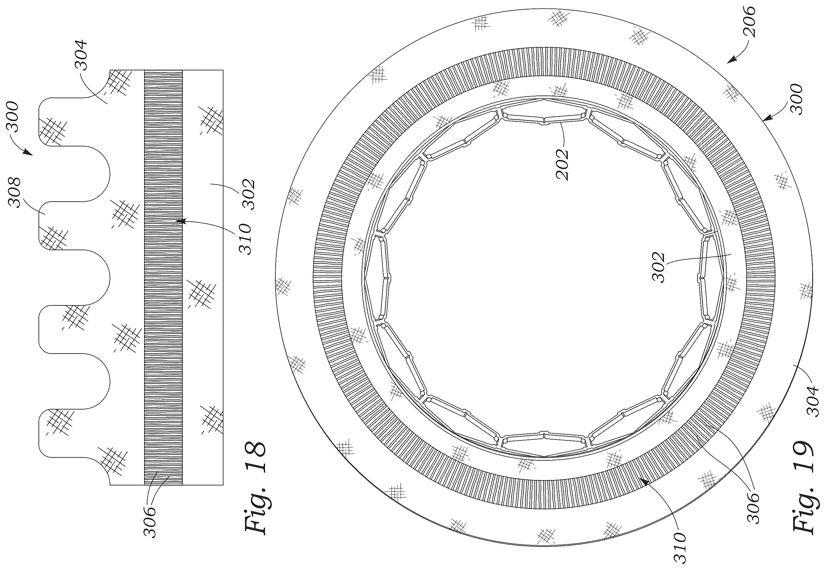 Patent US12551336 Figure 10 – Sealing element for prosthetic heart valve