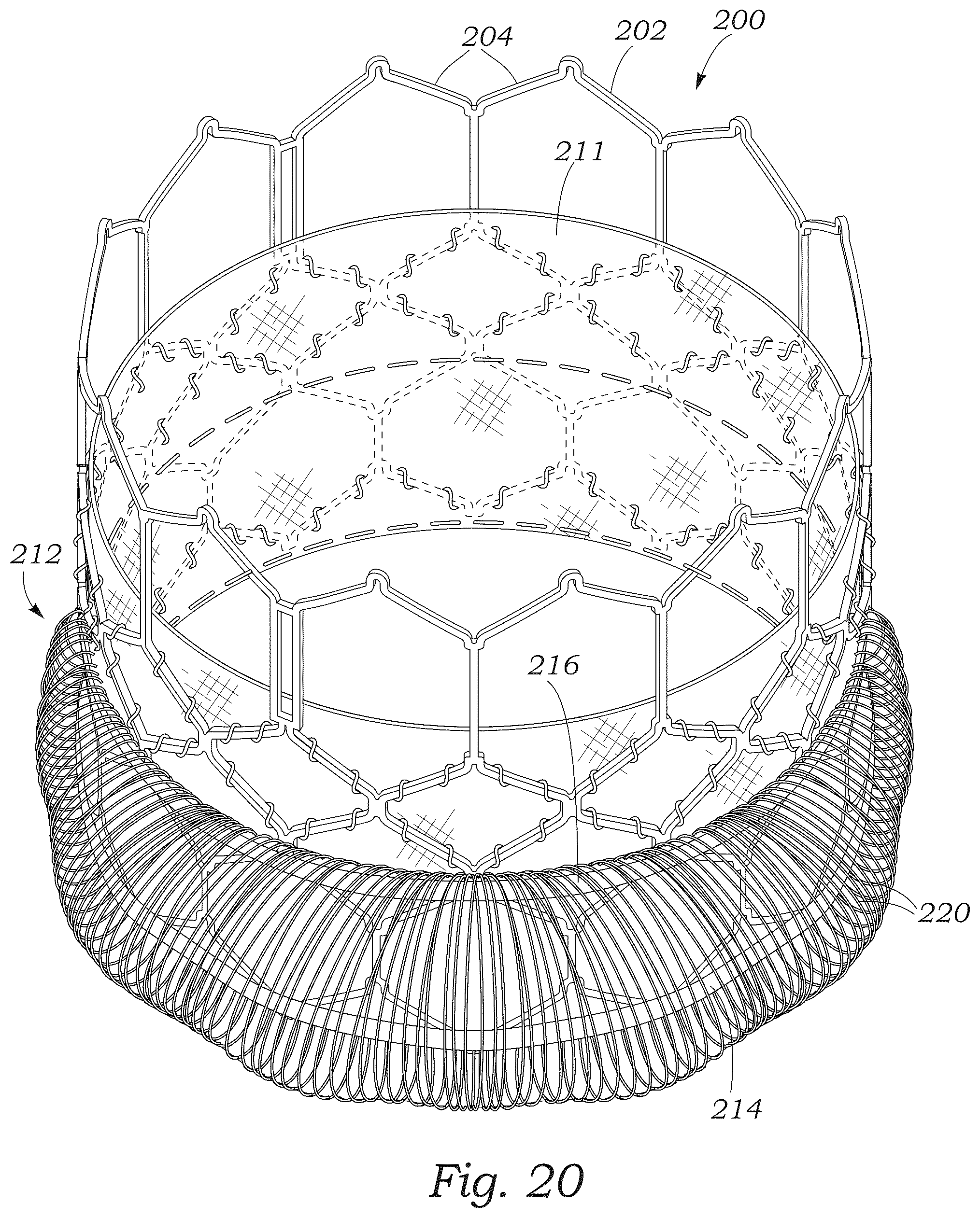 Patent US12551336 Figure 11 – Sealing element for prosthetic heart valve