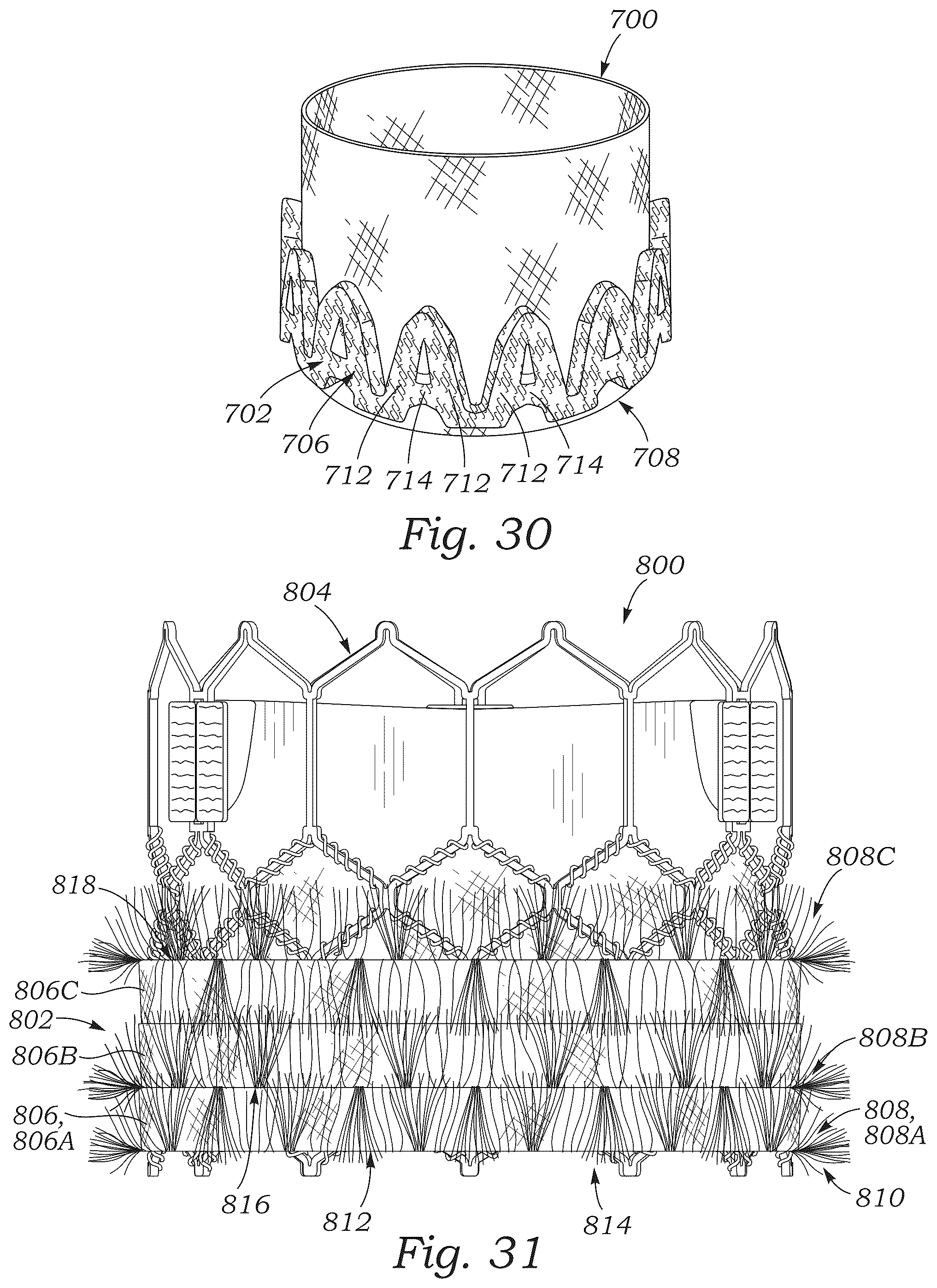Patent US12551336 Figure 16 – Sealing element for prosthetic heart valve