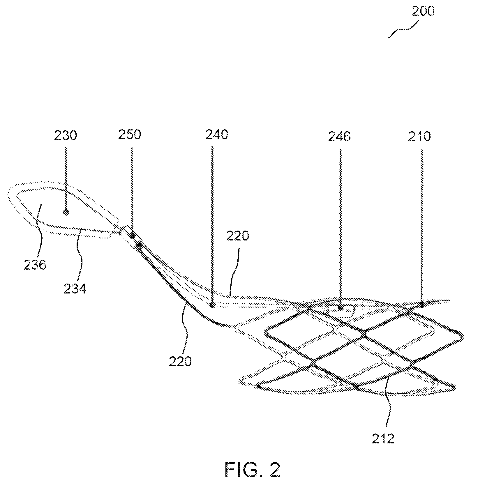 Patent US12551337 Figure 2 – Prosthetic implant, delivery system and delivery apparatus