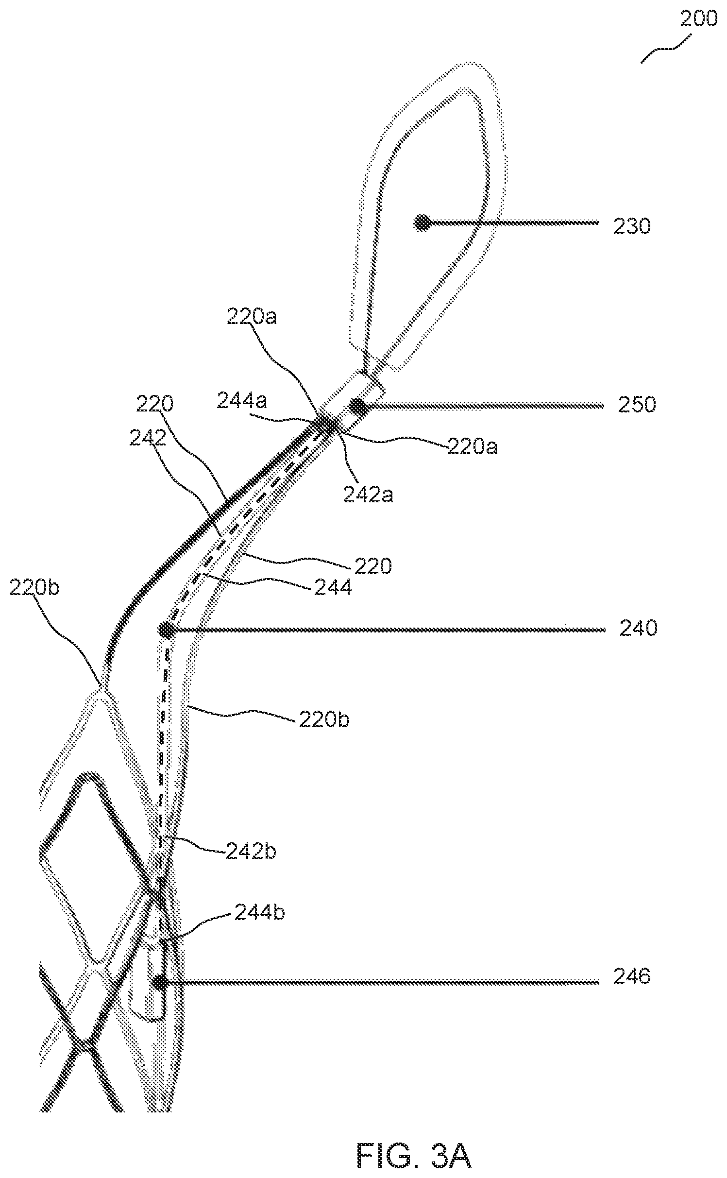 Patent US12551337 Figure 3 – Prosthetic implant, delivery system and delivery apparatus