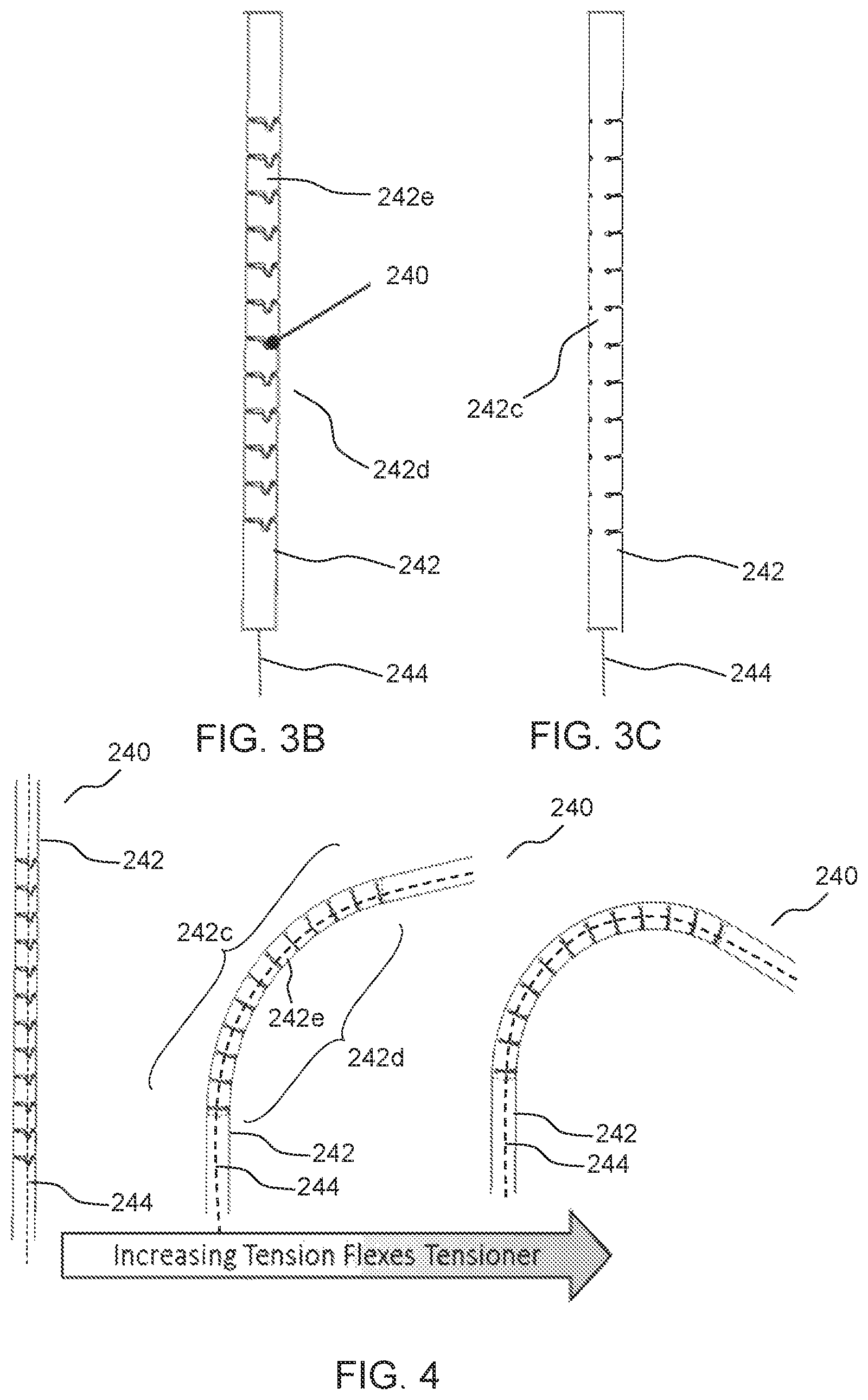 Patent US12551337 Figure 4 – Prosthetic implant, delivery system and delivery apparatus