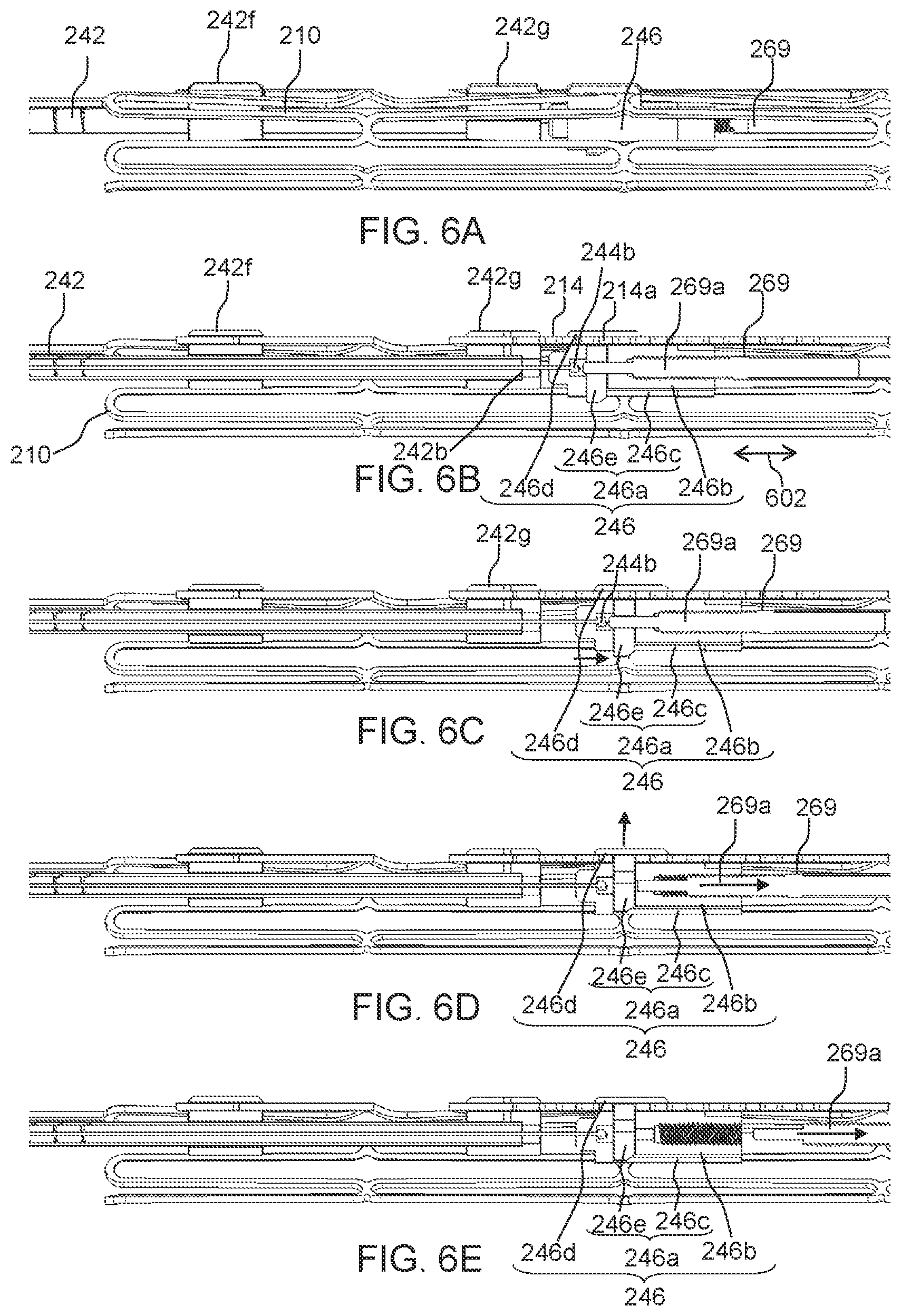 Patent US12551337 Figure 6 – Prosthetic implant, delivery system and delivery apparatus