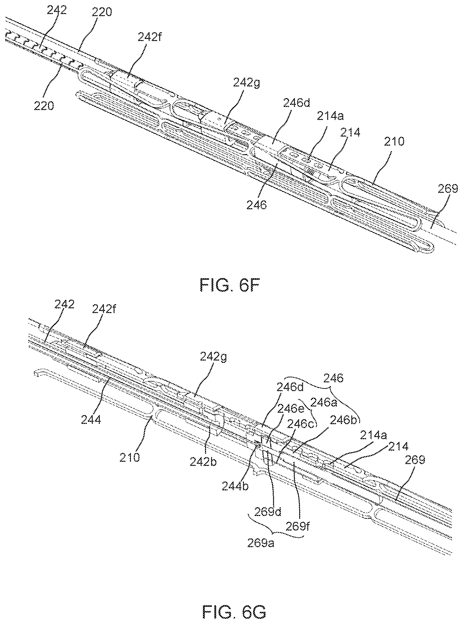 Patent US12551337 Figure 7 – Prosthetic implant, delivery system and delivery apparatus