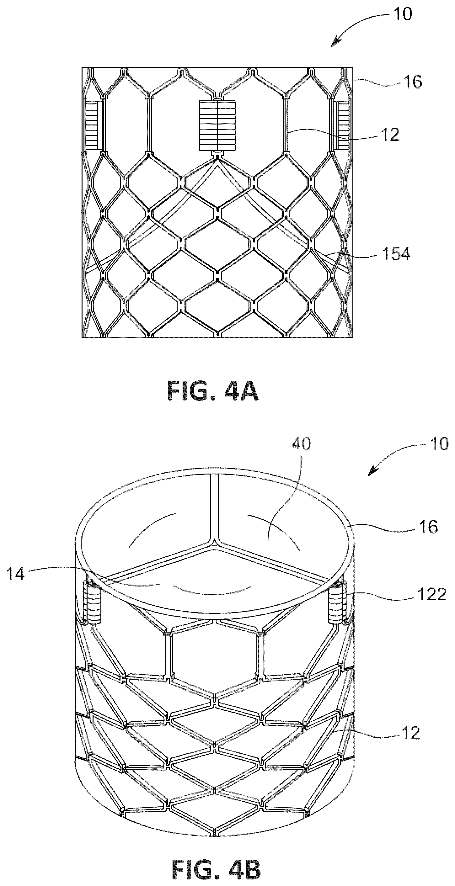 Patent US12551338 Figure 6 – Transcatheter pulmonic regenerative valve