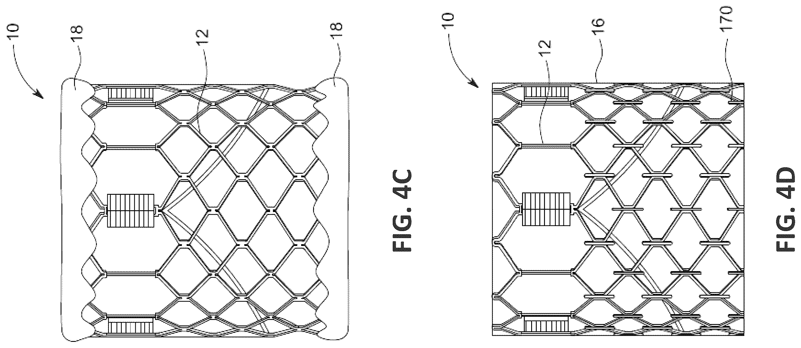 Patent US12551338 Figure 7 – Transcatheter pulmonic regenerative valve