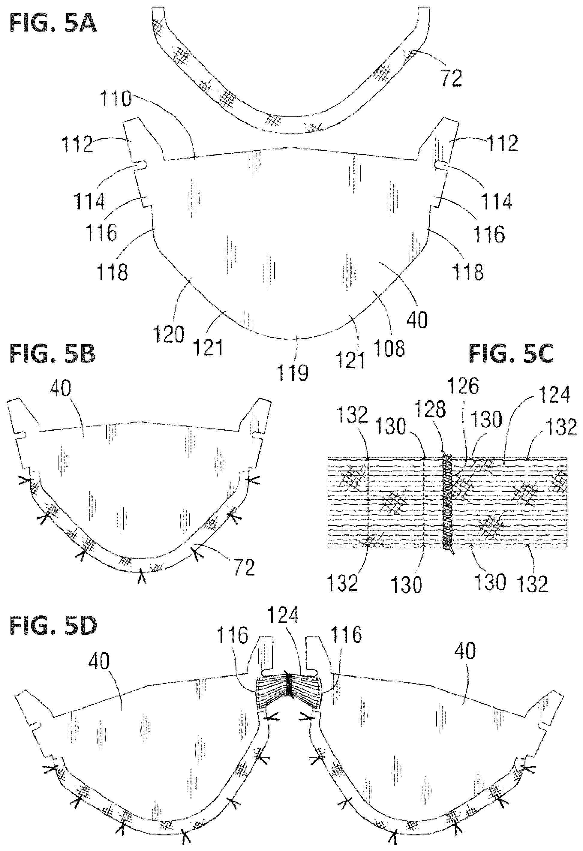 Patent US12551338 Figure 9 – Transcatheter pulmonic regenerative valve