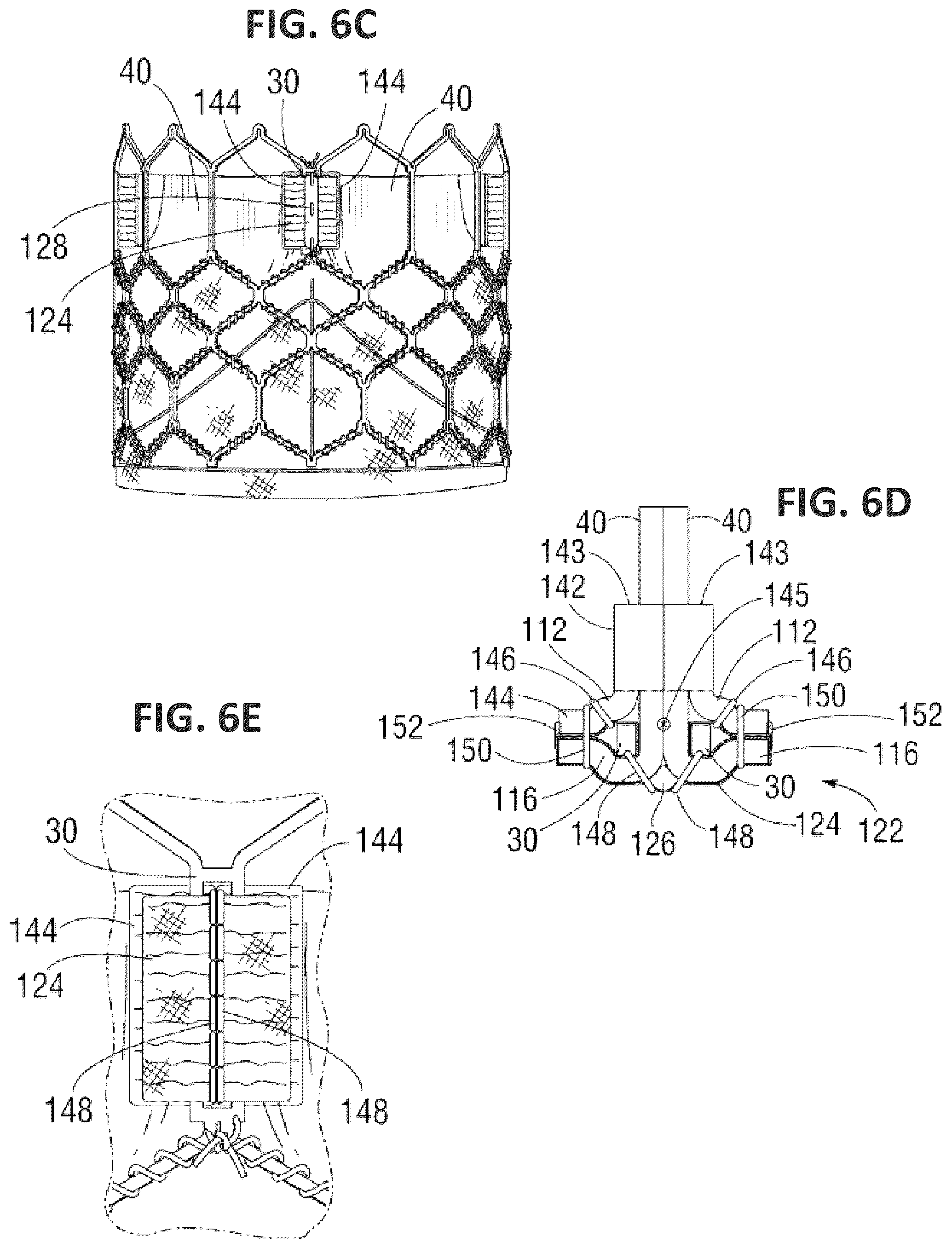 Patent US12551338 Figure 13 – Transcatheter pulmonic regenerative valve