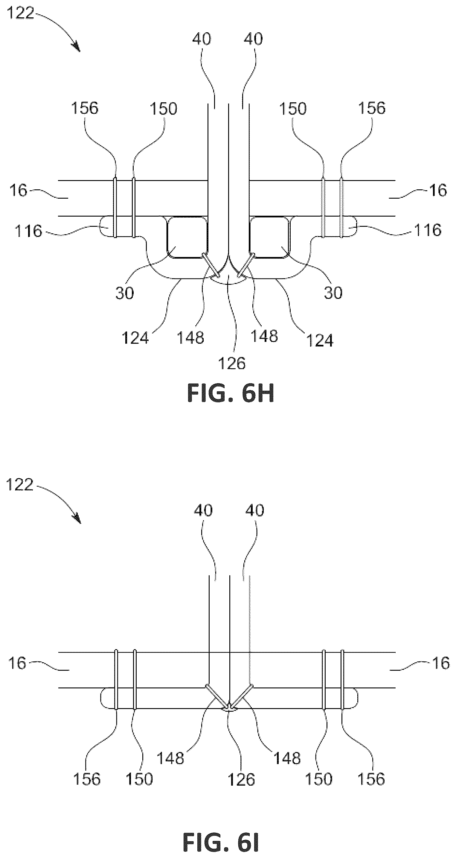 Patent US12551338 Figure 15 – Transcatheter pulmonic regenerative valve