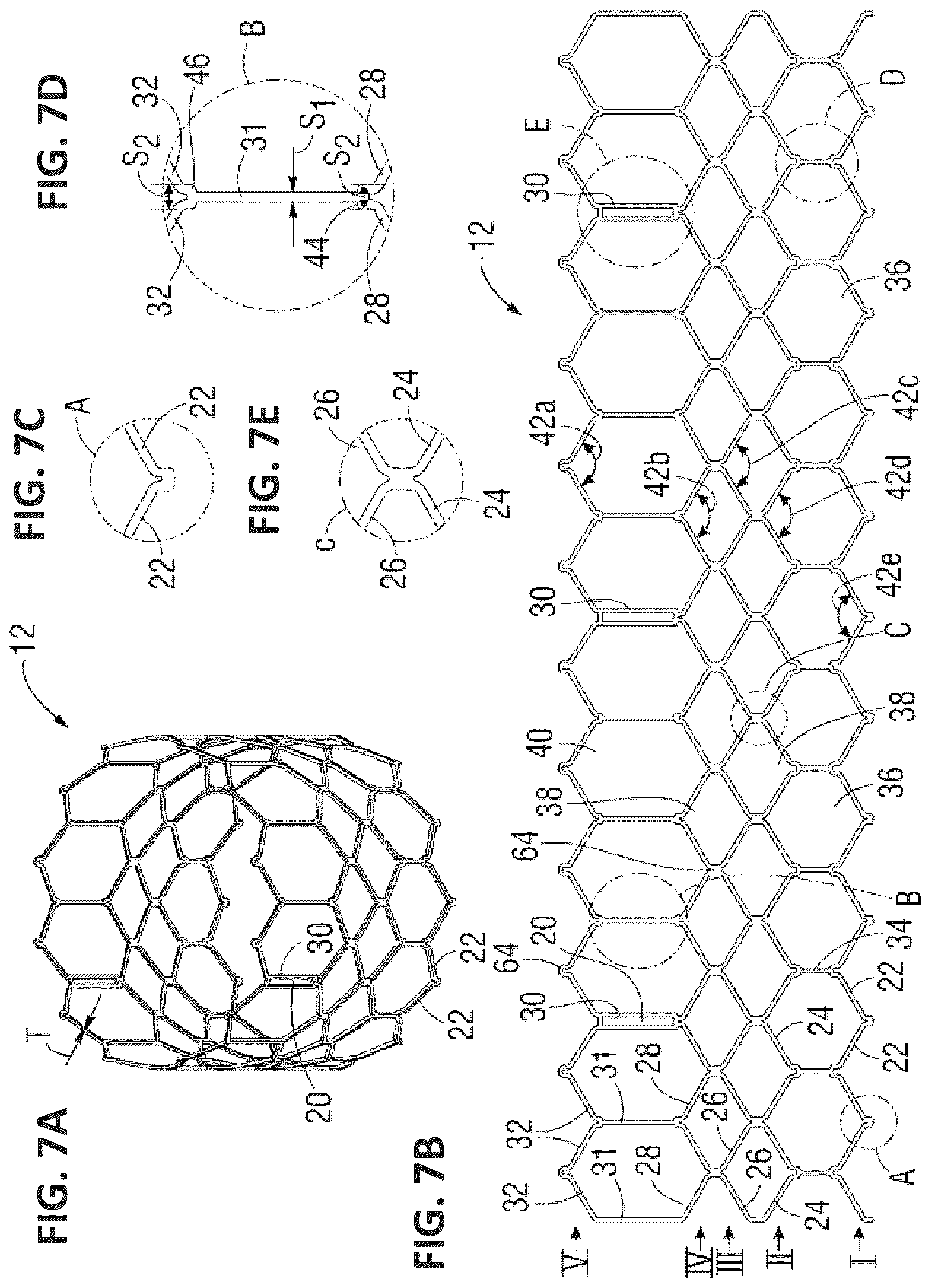 Patent US12551338 Figure 16 – Transcatheter pulmonic regenerative valve