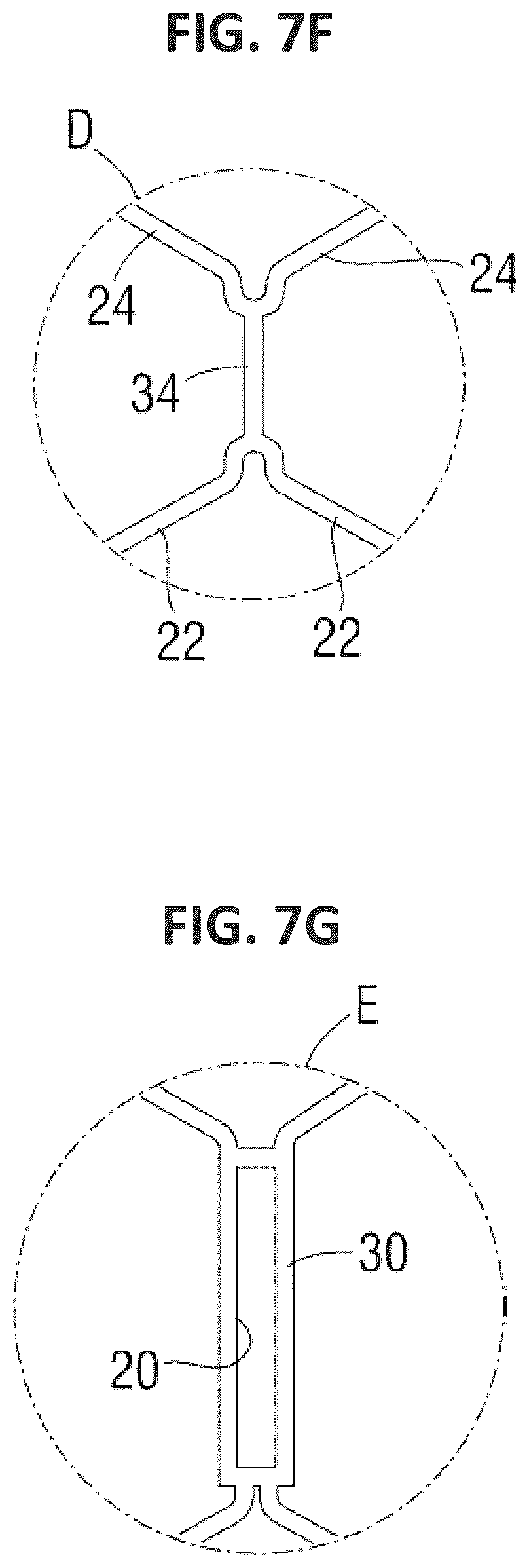 Patent US12551338 Figure 17 – Transcatheter pulmonic regenerative valve