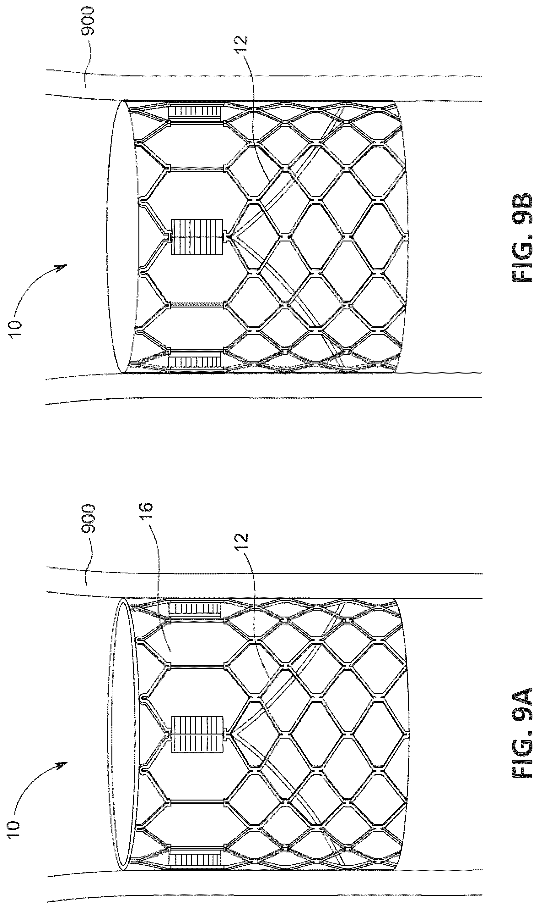 Patent US12551338 Figure 20 – Transcatheter pulmonic regenerative valve