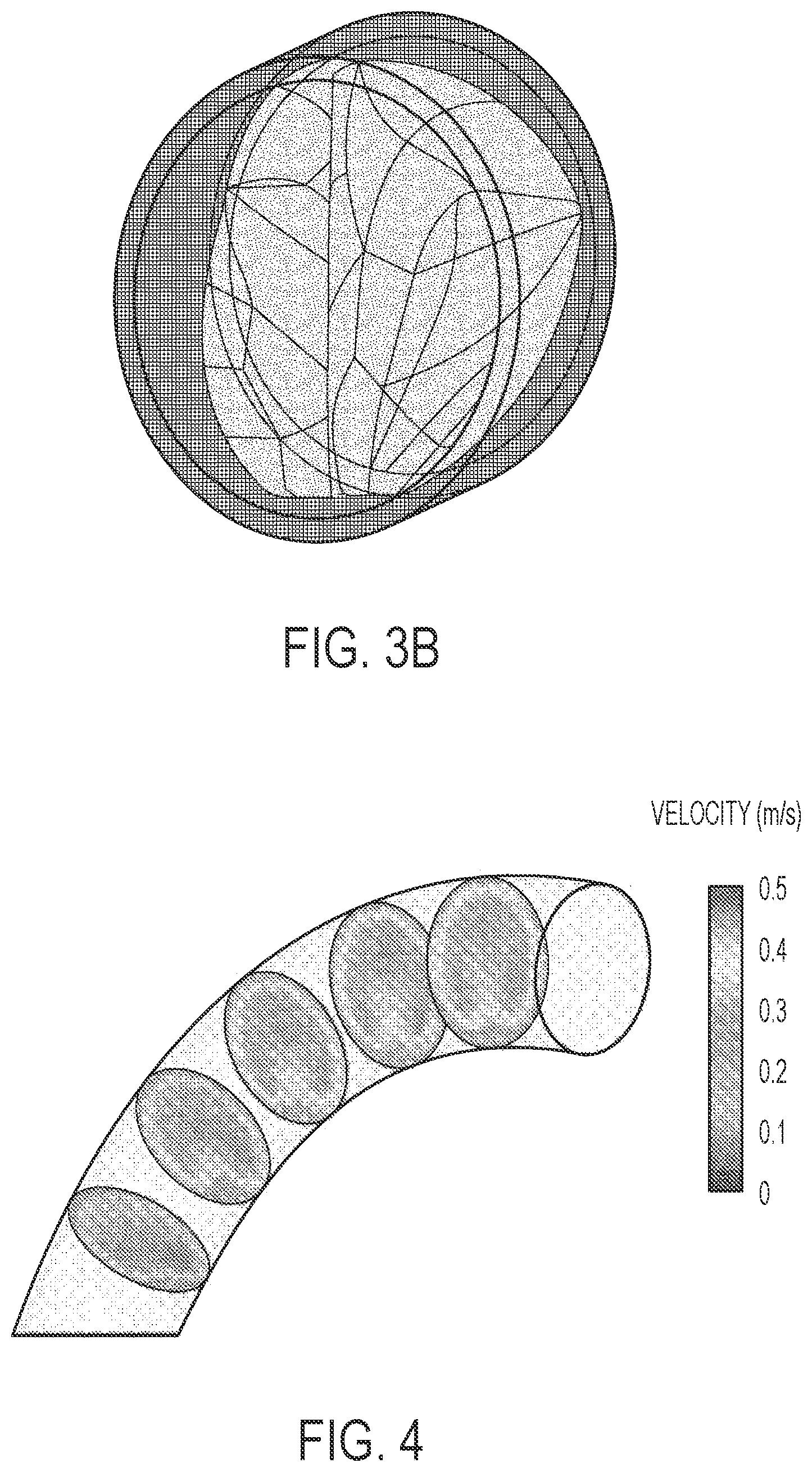 Patent US12551339 Figure 3 – Expandable implantable conduit