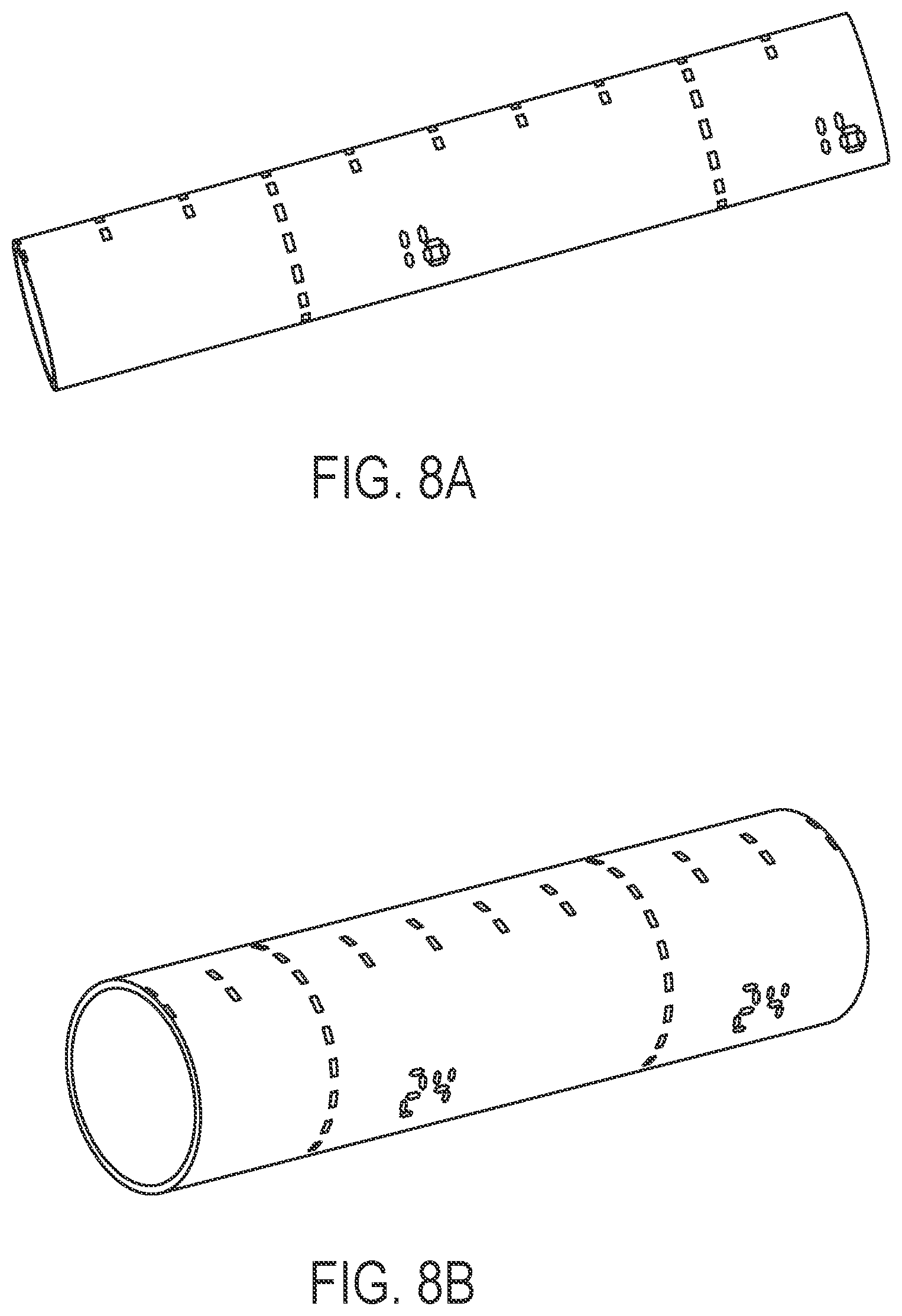 Patent US12551339 Figure 7 – Expandable implantable conduit