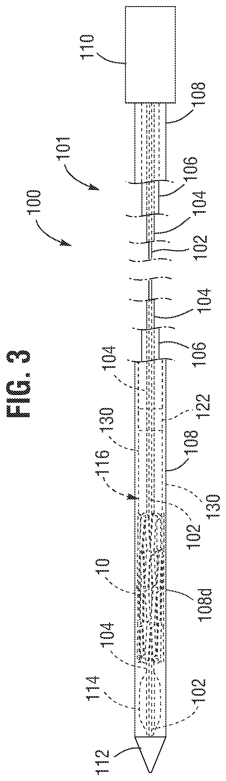Patent US12551340 Figure 3 – Prosthetic valve delivery assembly