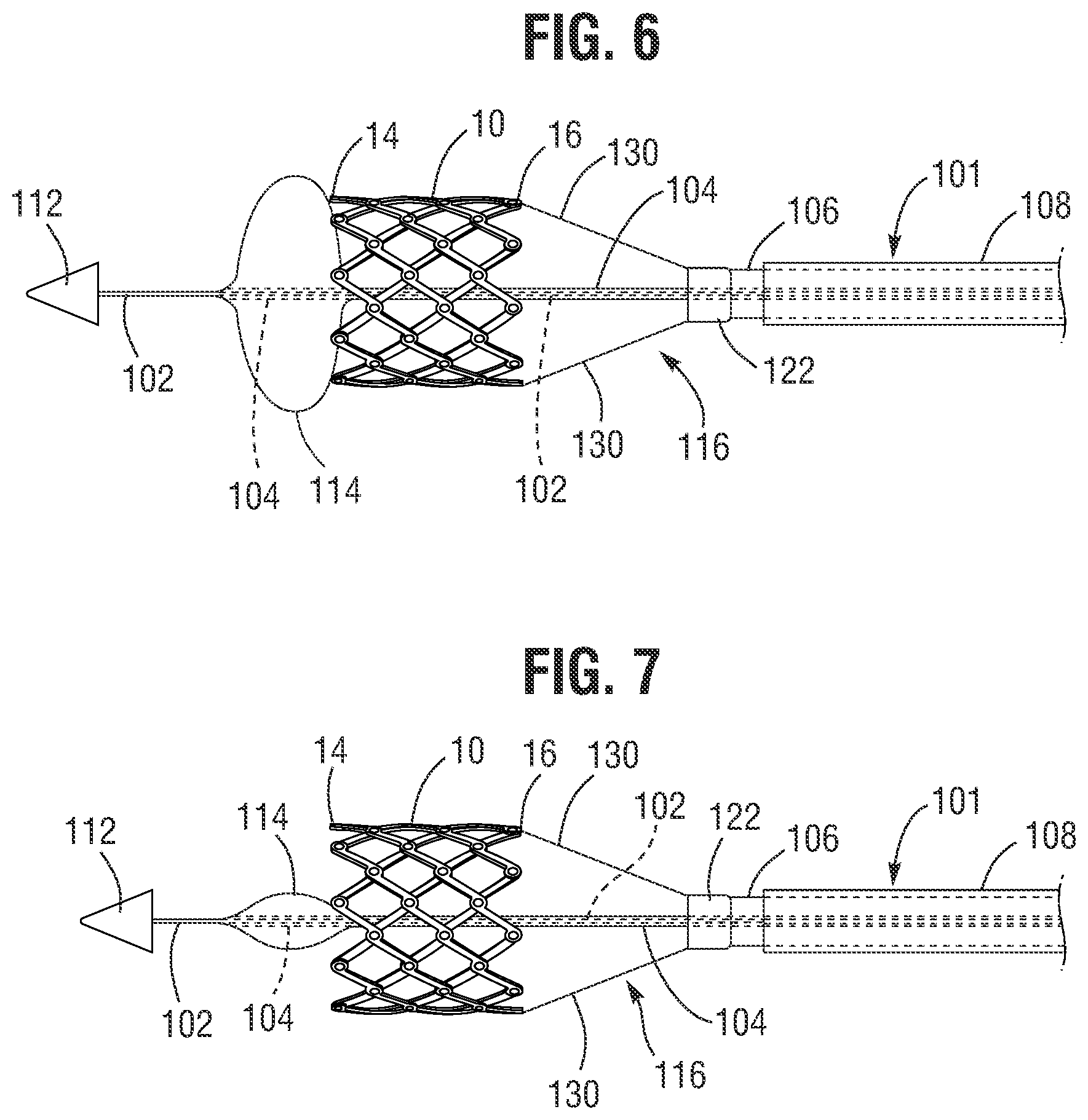 Patent US12551340 Figure 5 – Prosthetic valve delivery assembly