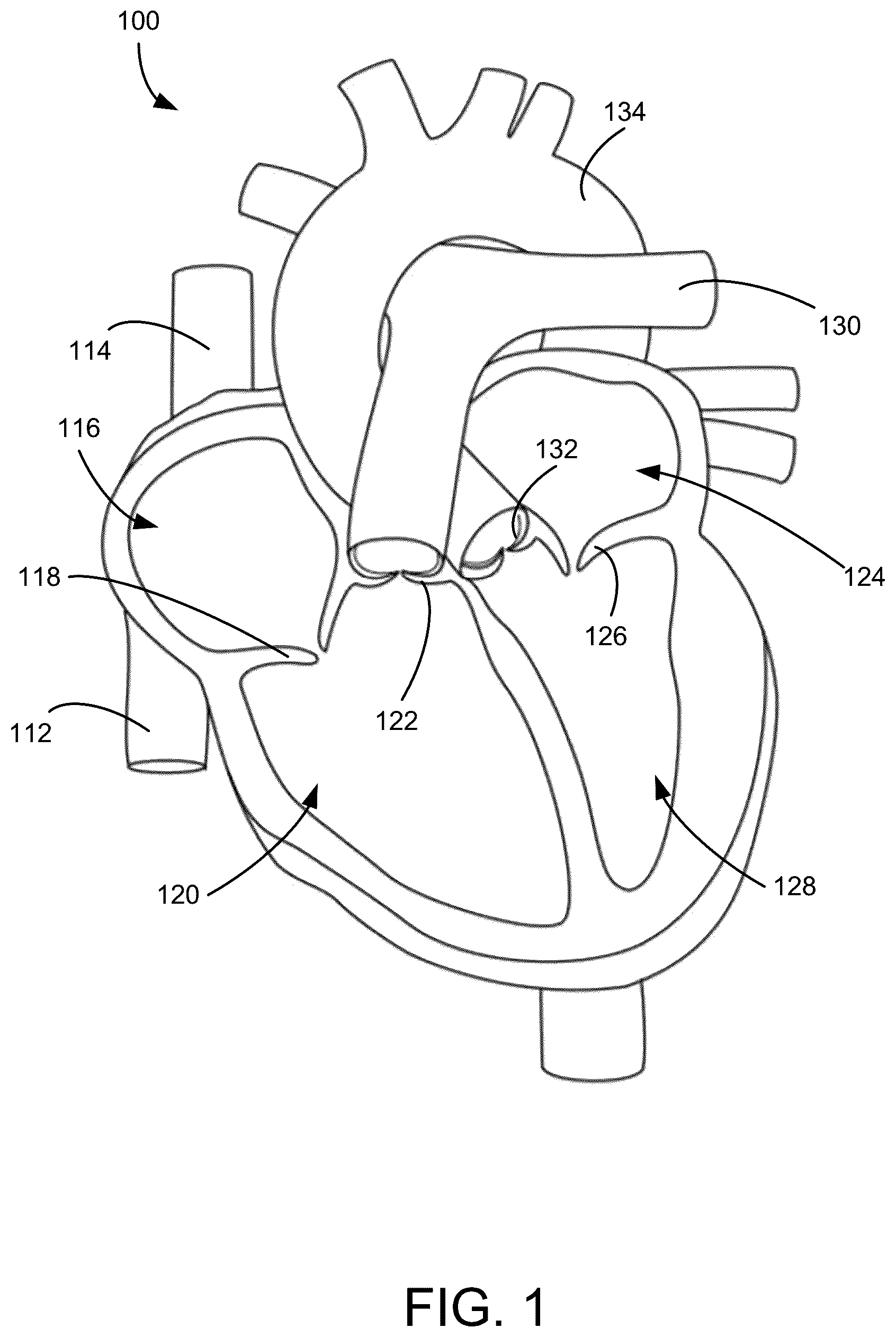 Patent US12551341 Figure 1 – Heart valve clip