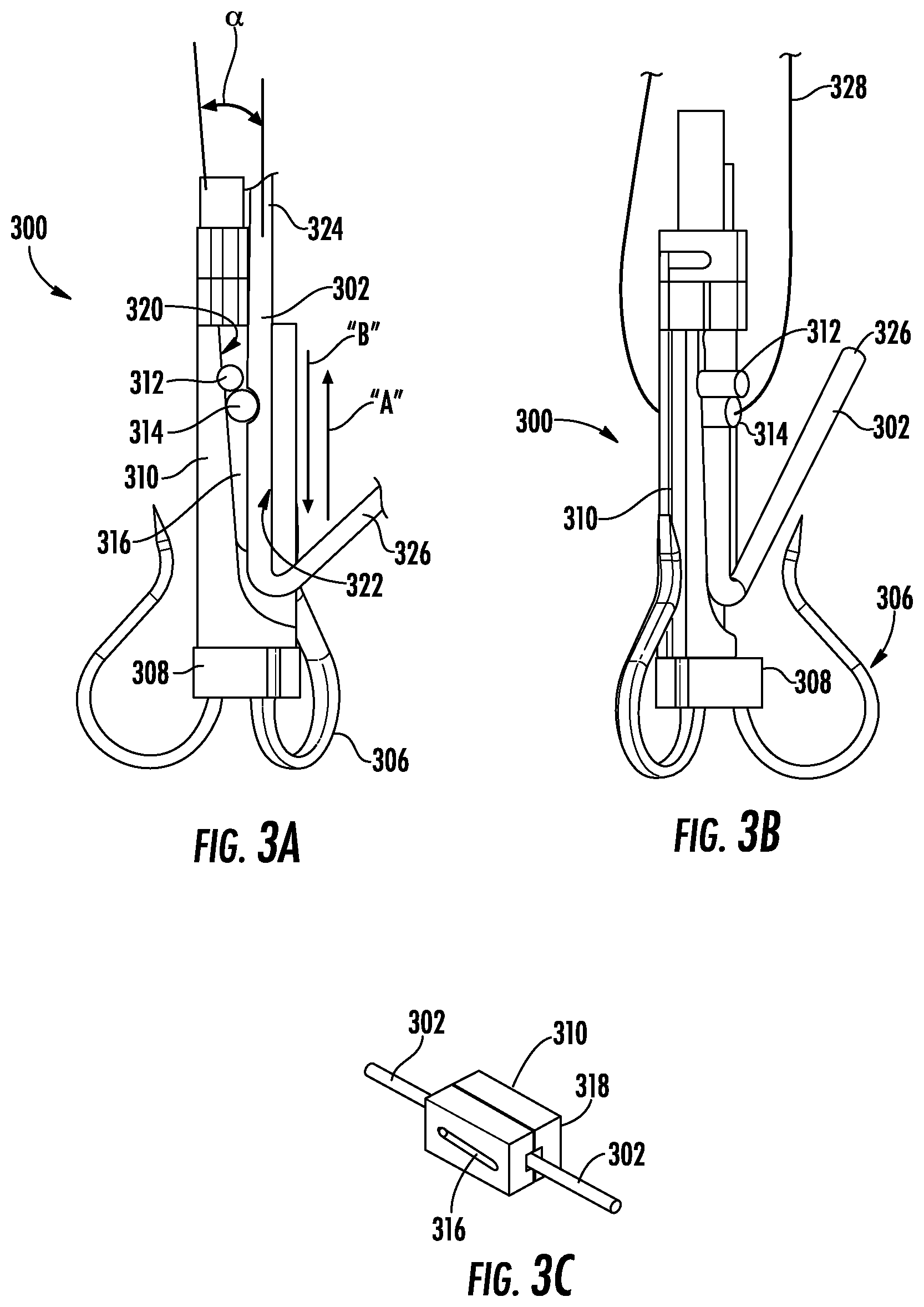 Patent US12551342 Figure 3 – Devices, systems, and methods for adjustably tensioning an artificial chordae tendineae between a leaflet and a papillary muscle or heart wall
