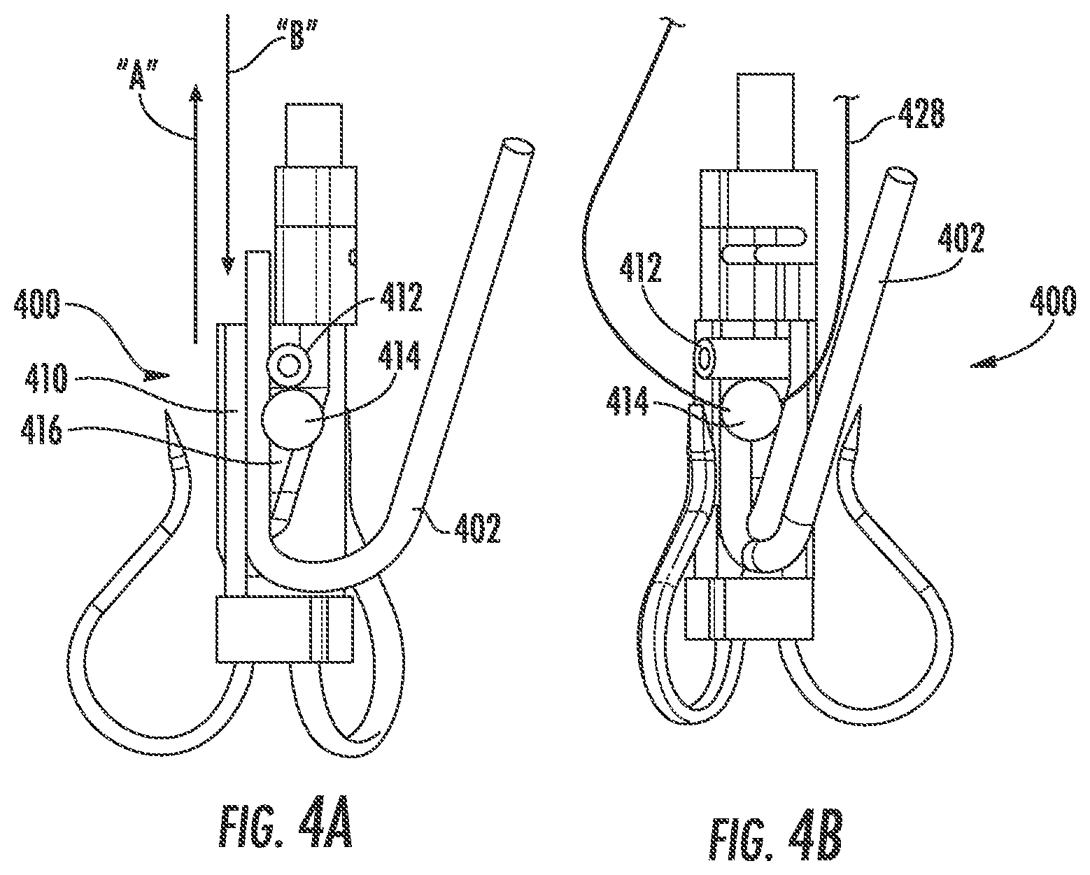 Patent US12551342 Figure 4 – Devices, systems, and methods for adjustably tensioning an artificial chordae tendineae between a leaflet and a papillary muscle or heart wall