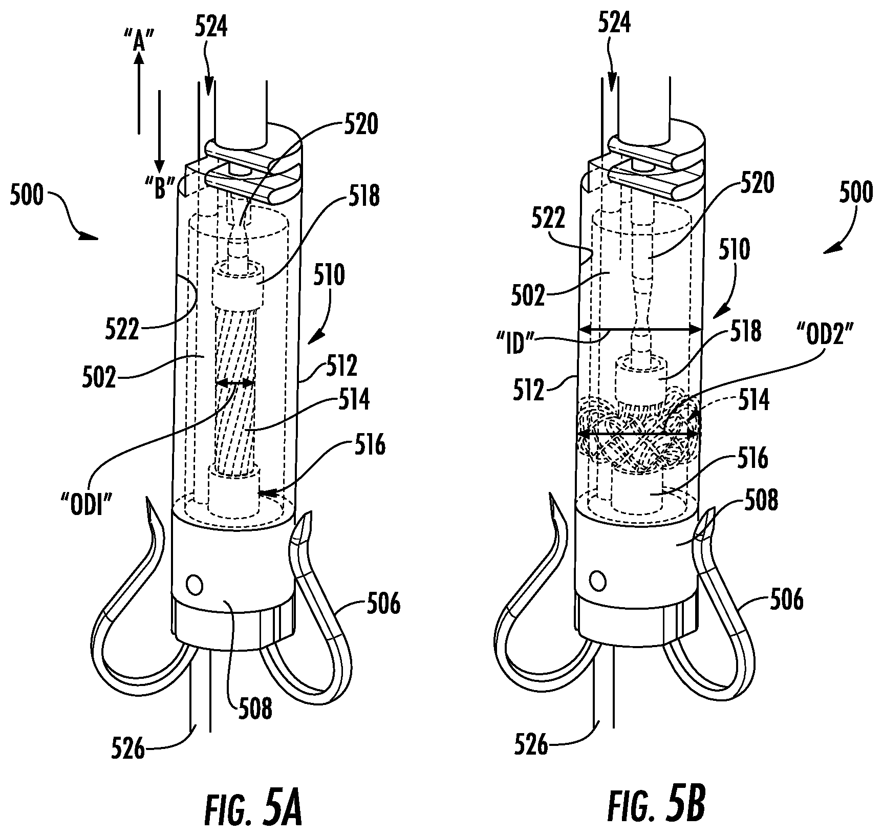 Patent US12551342 Figure 5 – Devices, systems, and methods for adjustably tensioning an artificial chordae tendineae between a leaflet and a papillary muscle or heart wall